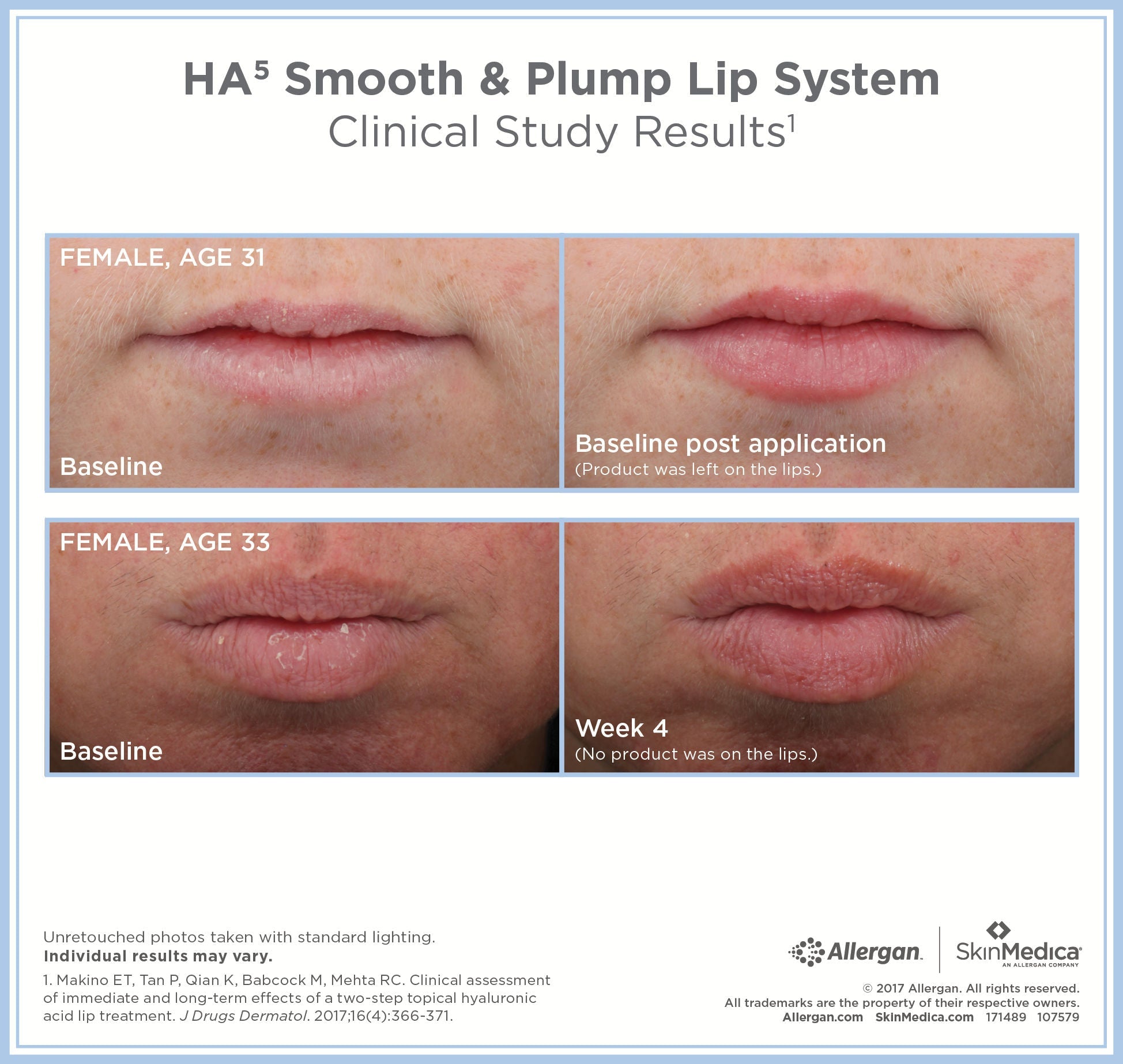 HA5 Smooth and Plump Lip System