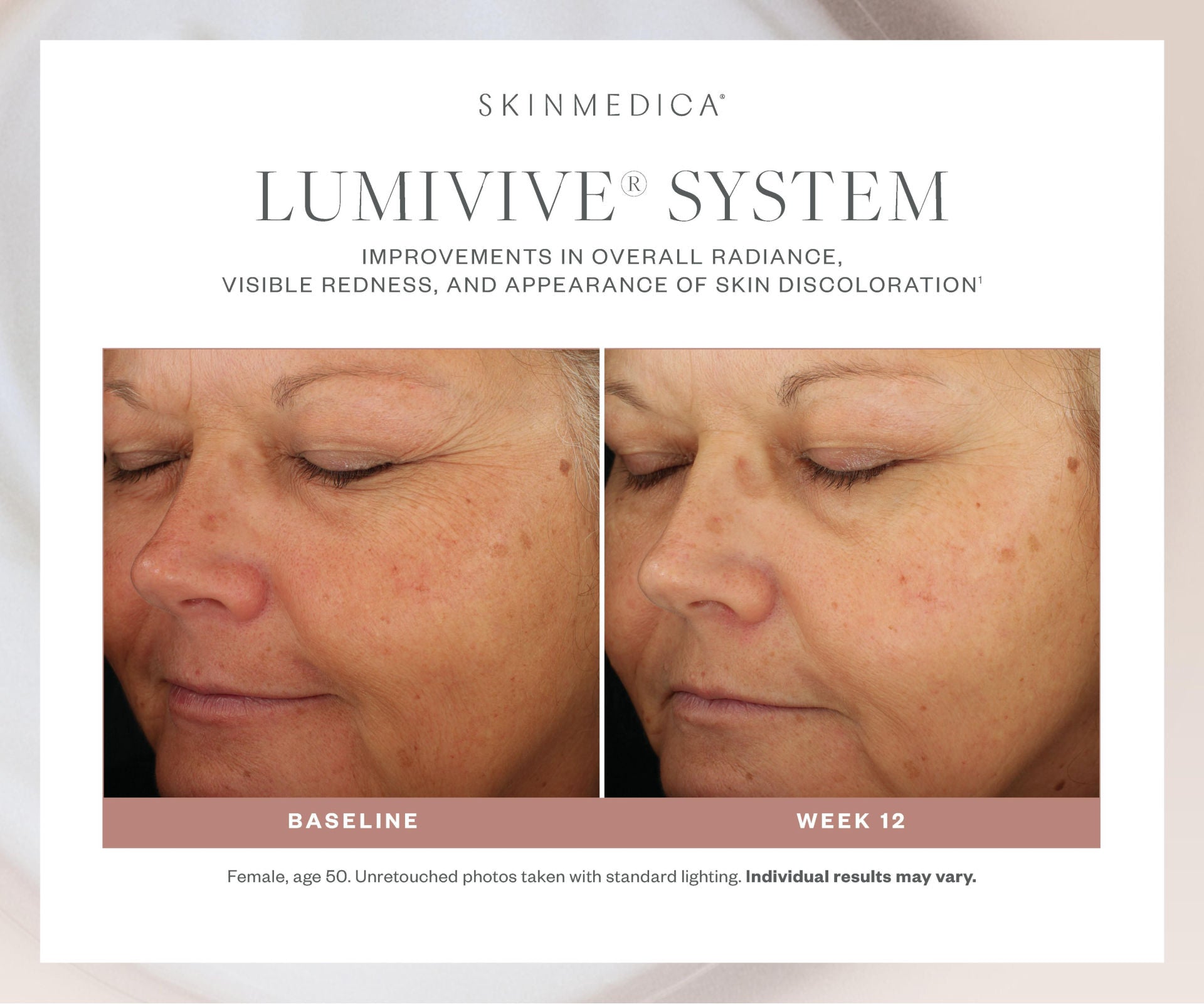Lumivive System, Day and Night