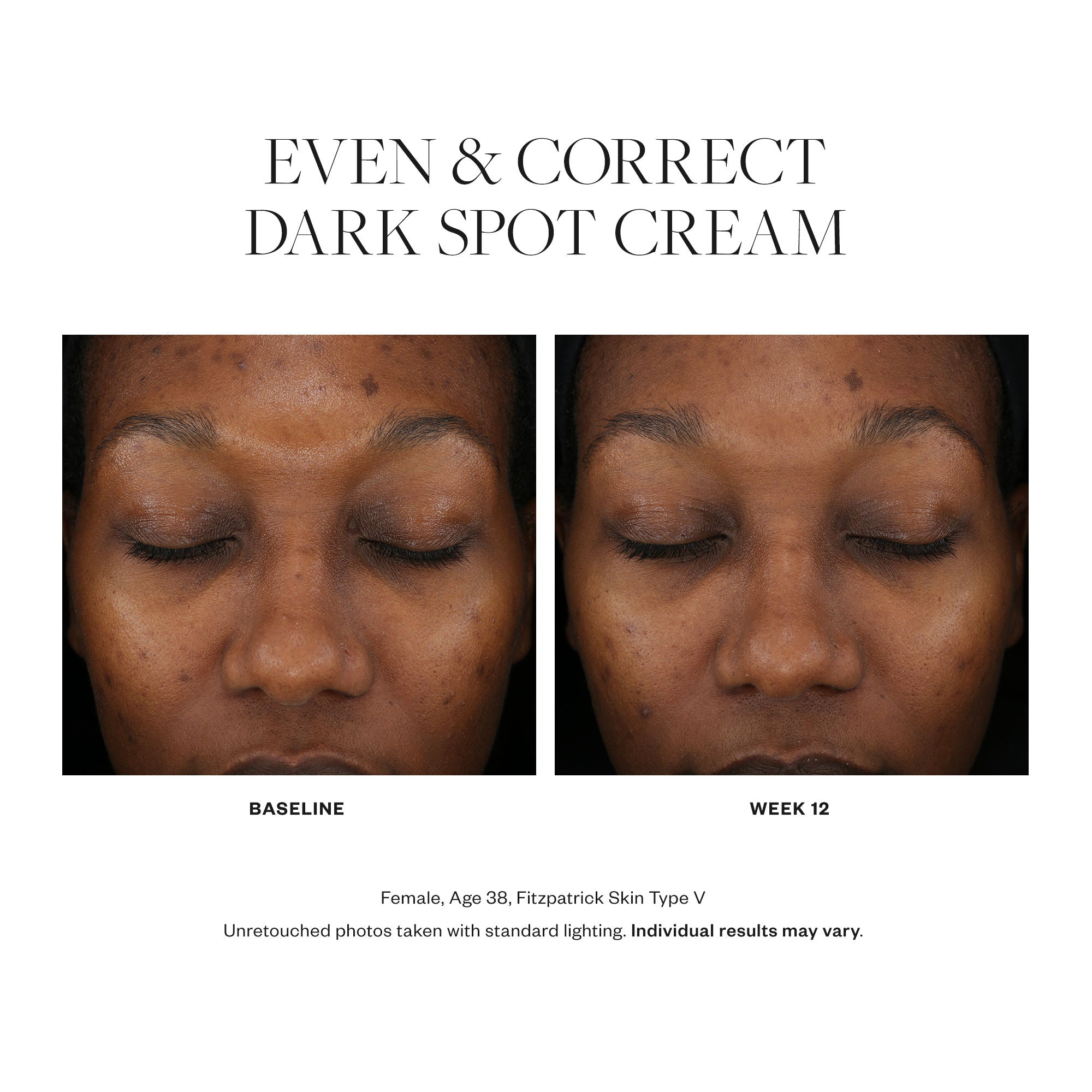 Even & Correct Dark Spot Cream