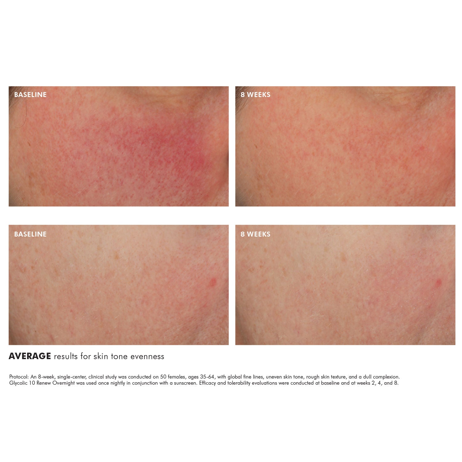 Glycolic 10 Renew Overnight