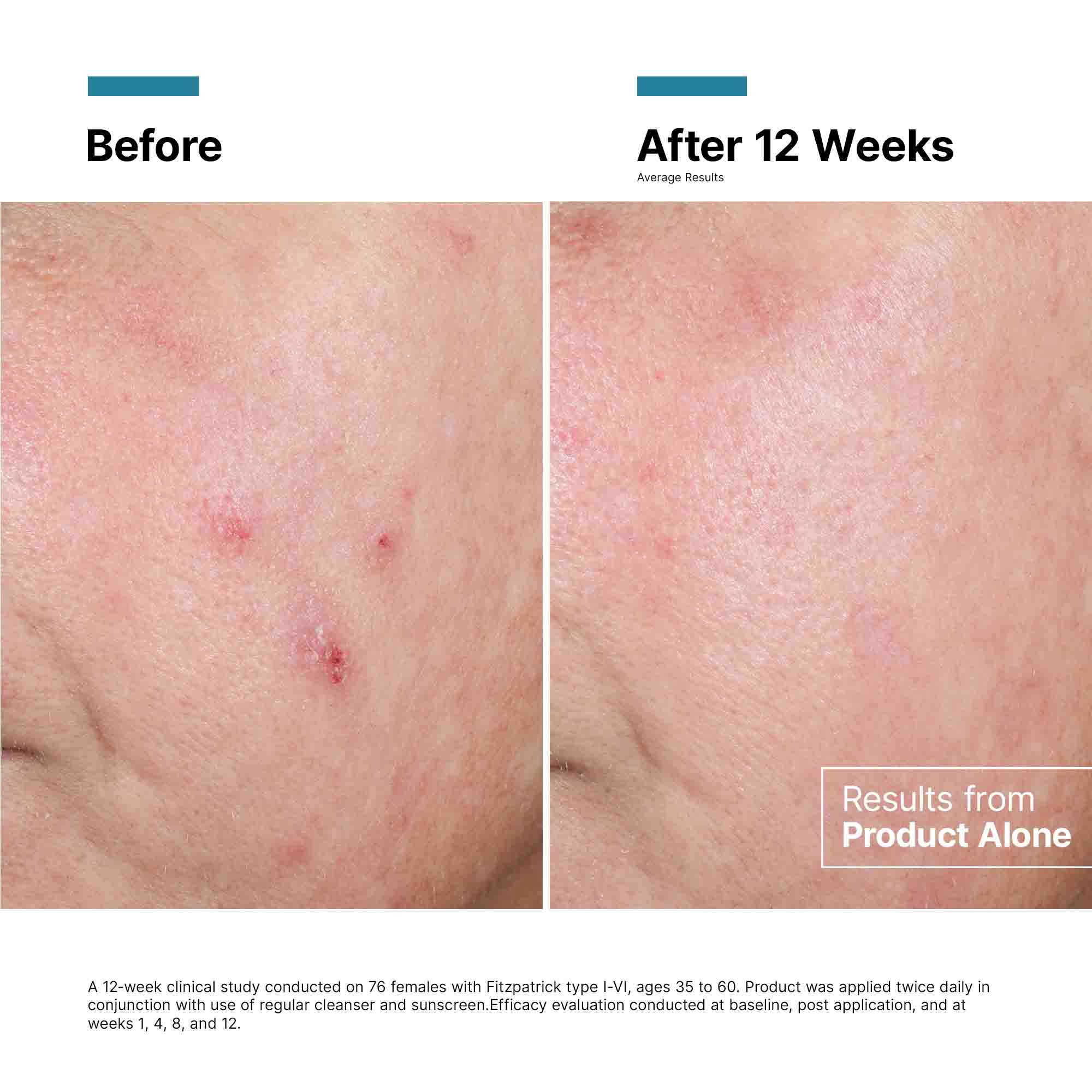 Advanced RGN-6 Regenerative Cream