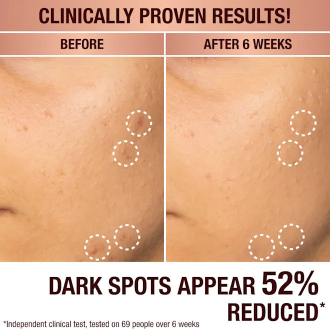 Dark Spot Correcting Radiance Recovery Serum