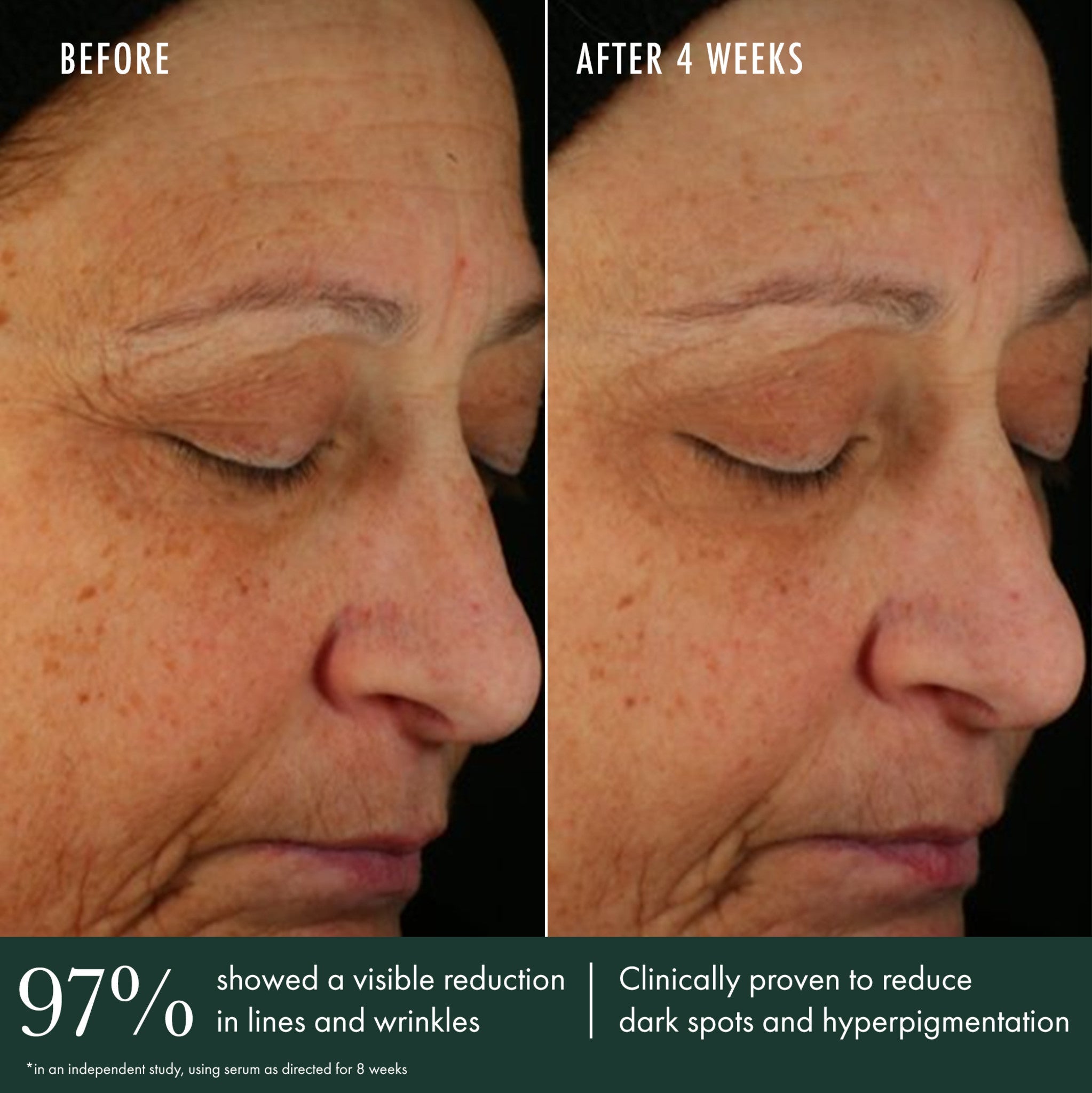 Brightening Serum