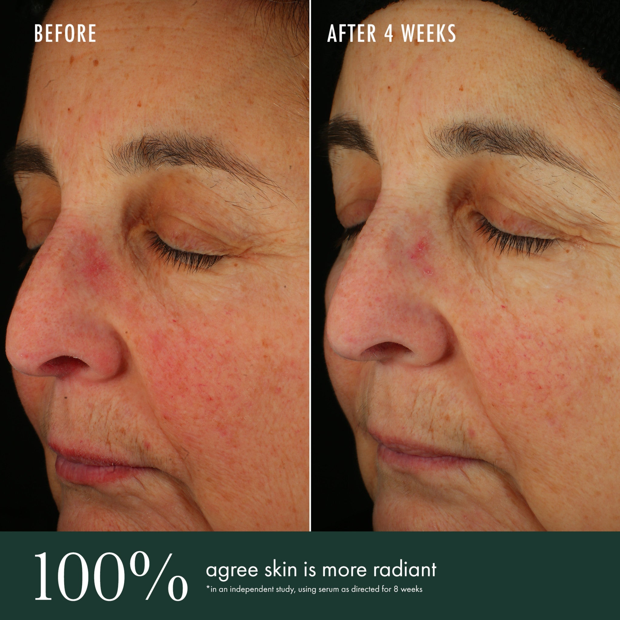 Brightening Serum