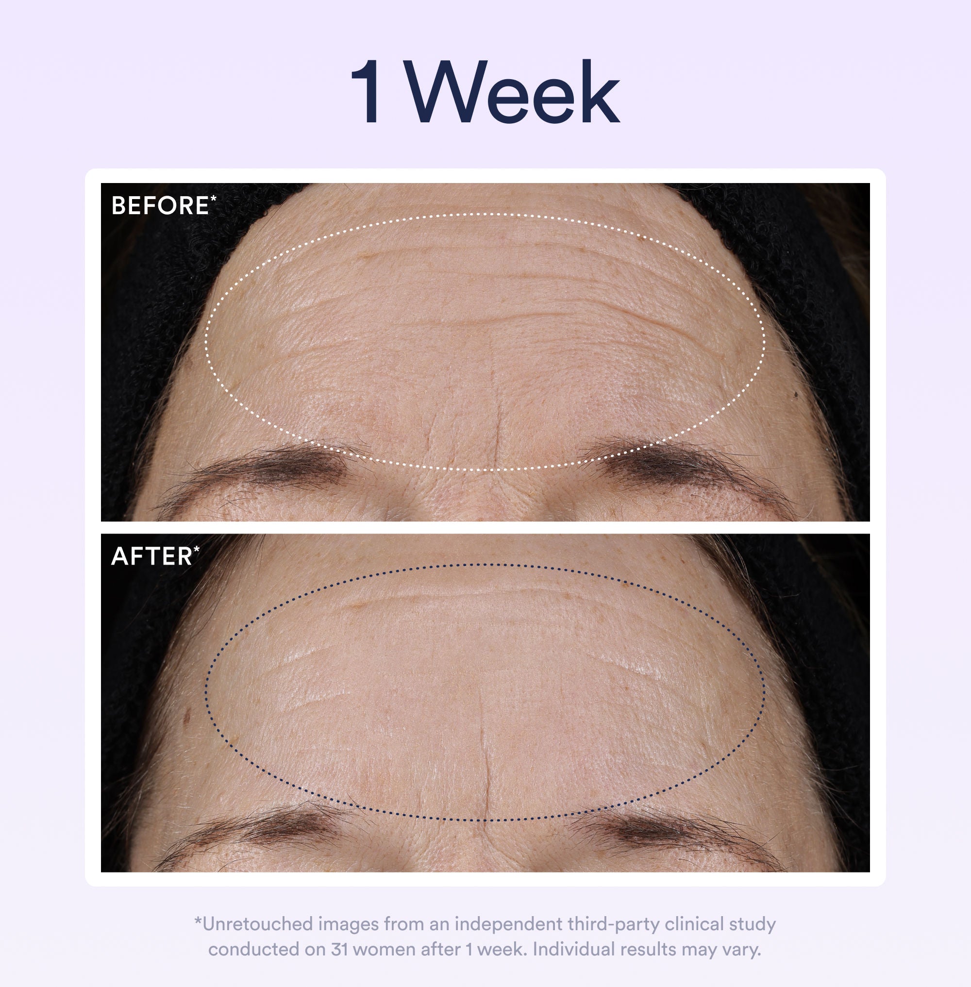 Dream Night Serum with Bio-Retinol