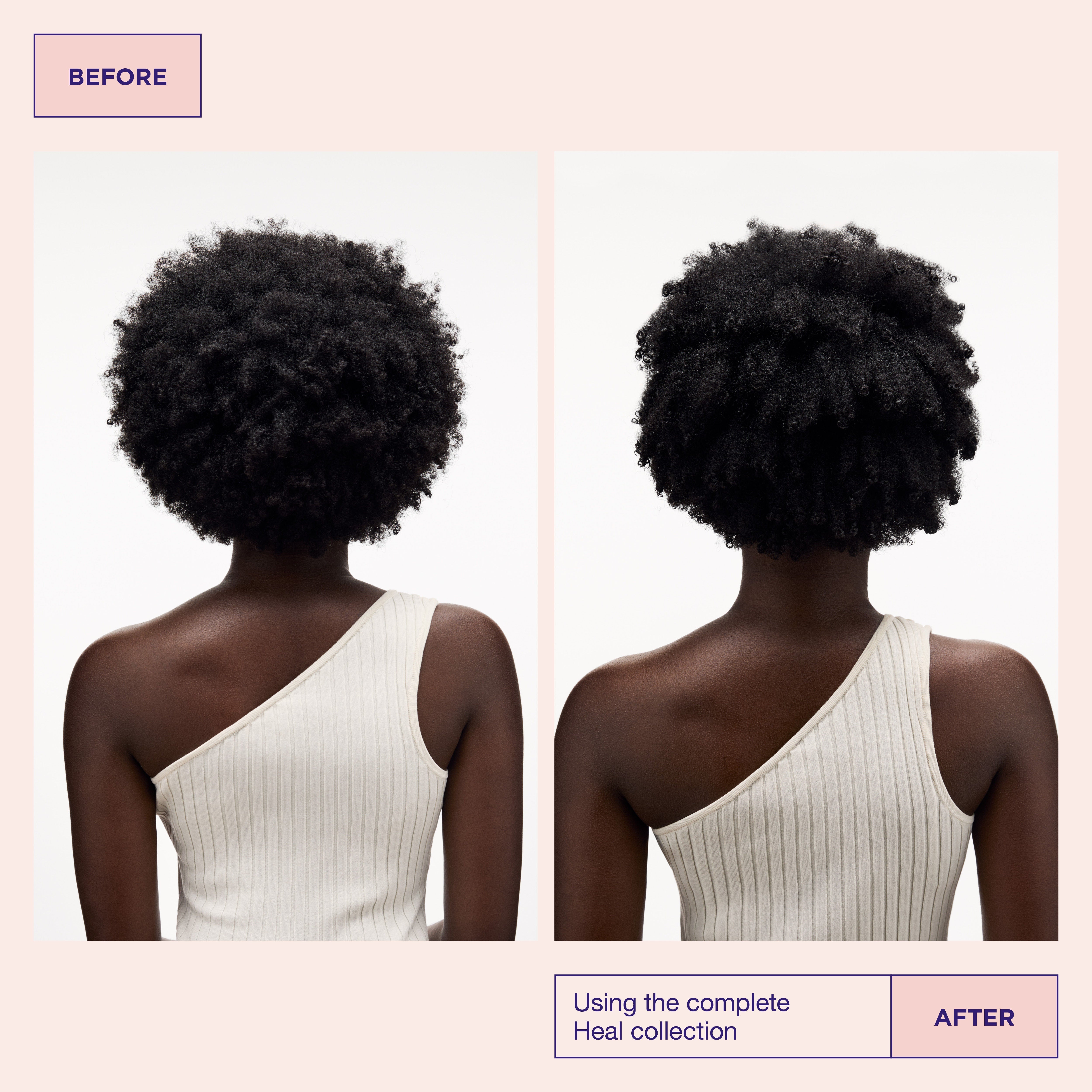 Head & Hair Heal Beauty Box (Limited Edition)