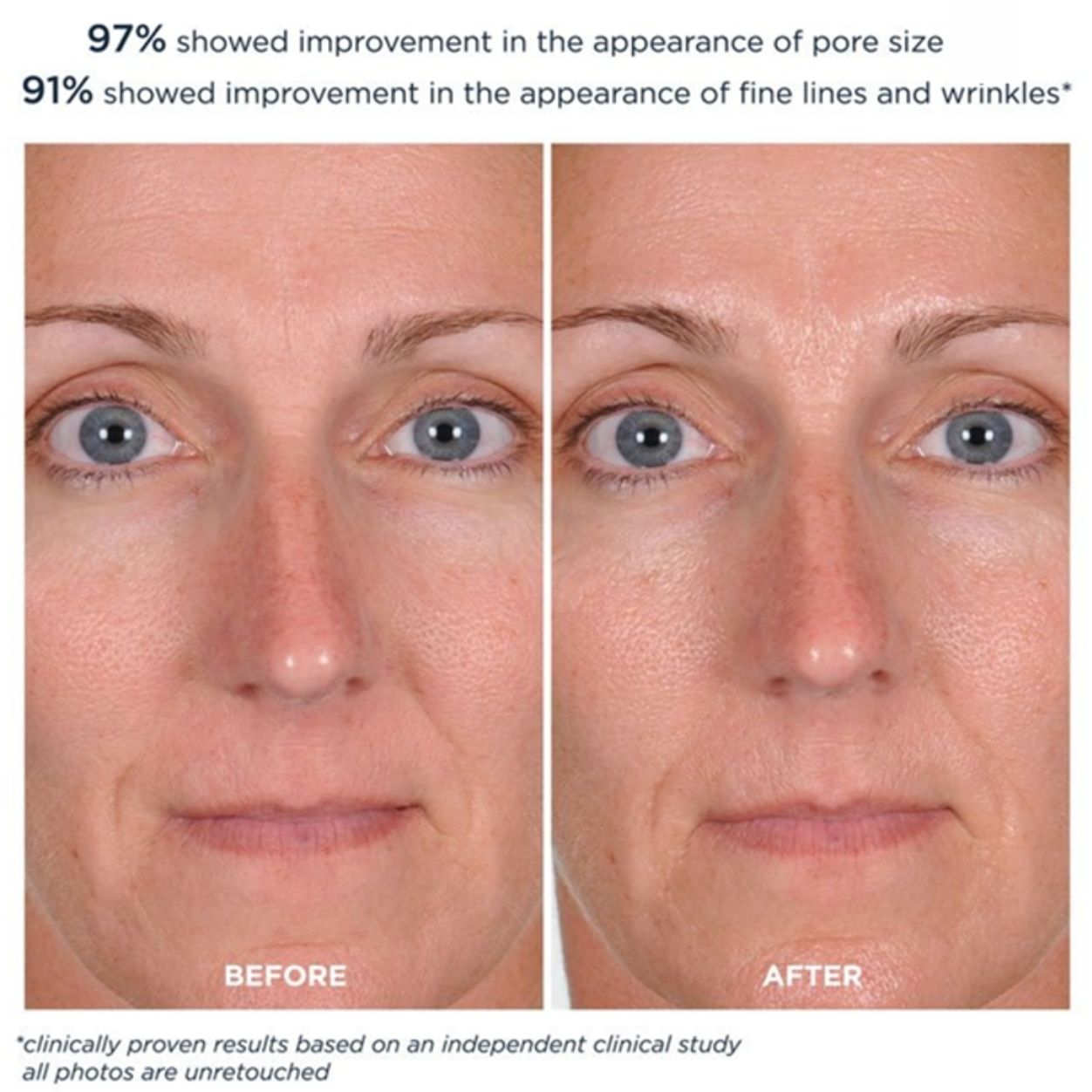 PowerGlow Peel Obsessed (Limited Edition)