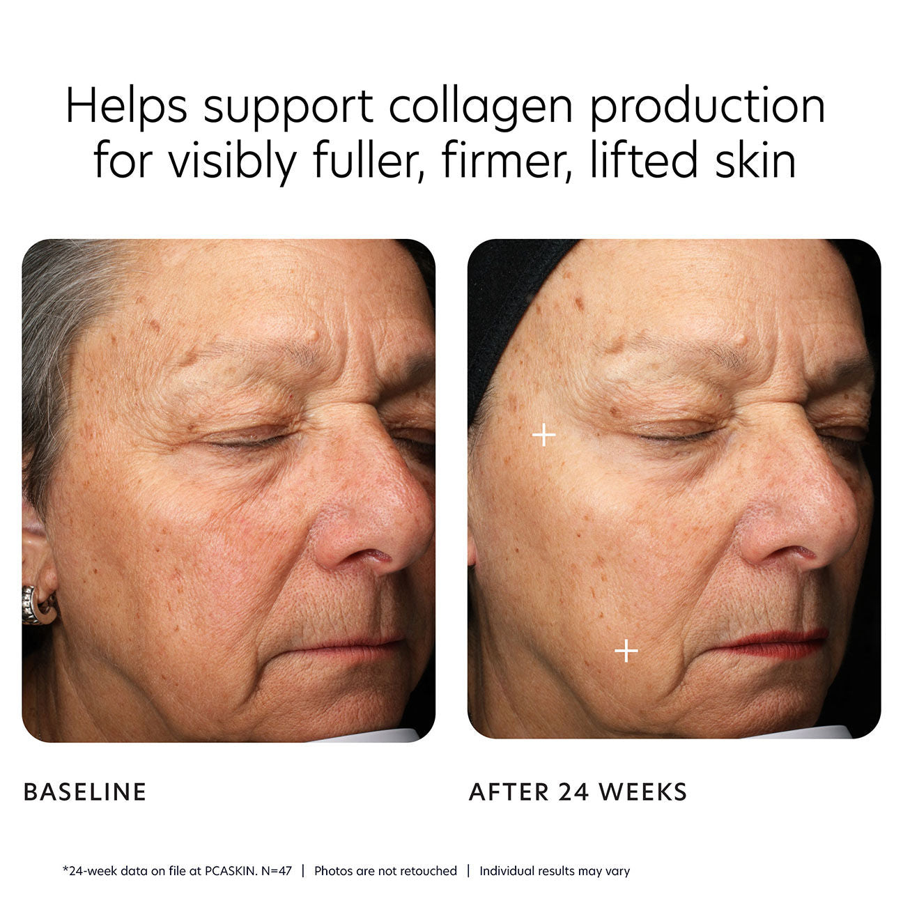 MGF Age Renewal Cream