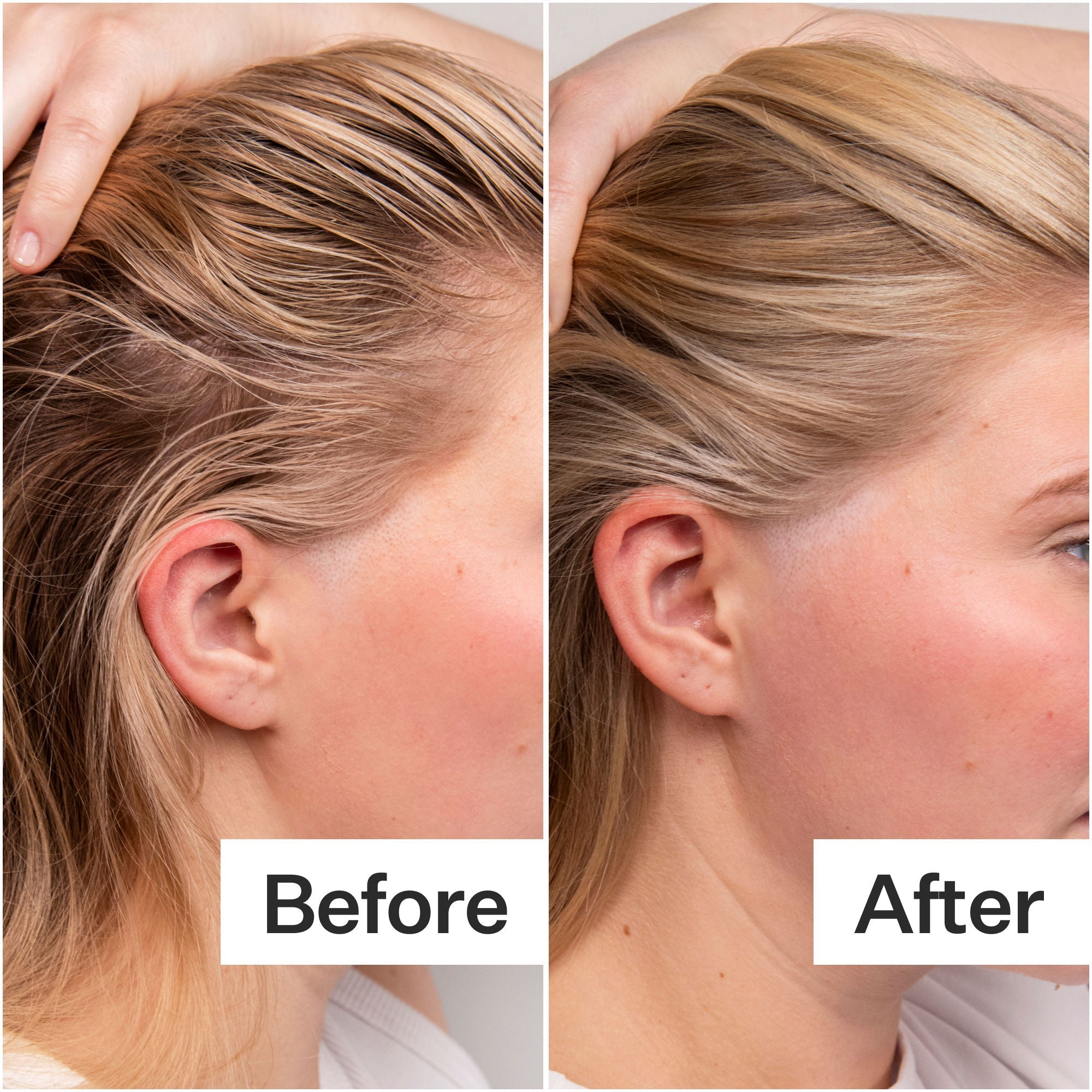 4% Niacinamide Oily Scalp Serum