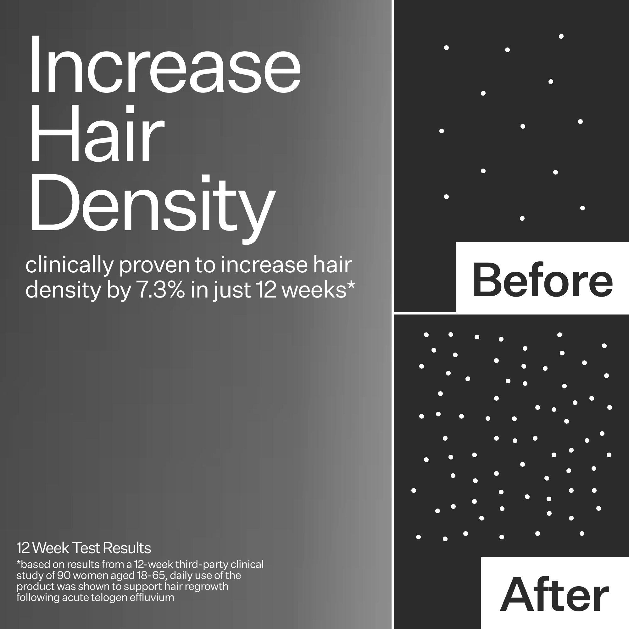 3% Stem Cell Peptide H3-Grow+ Complex Scalp Treatment