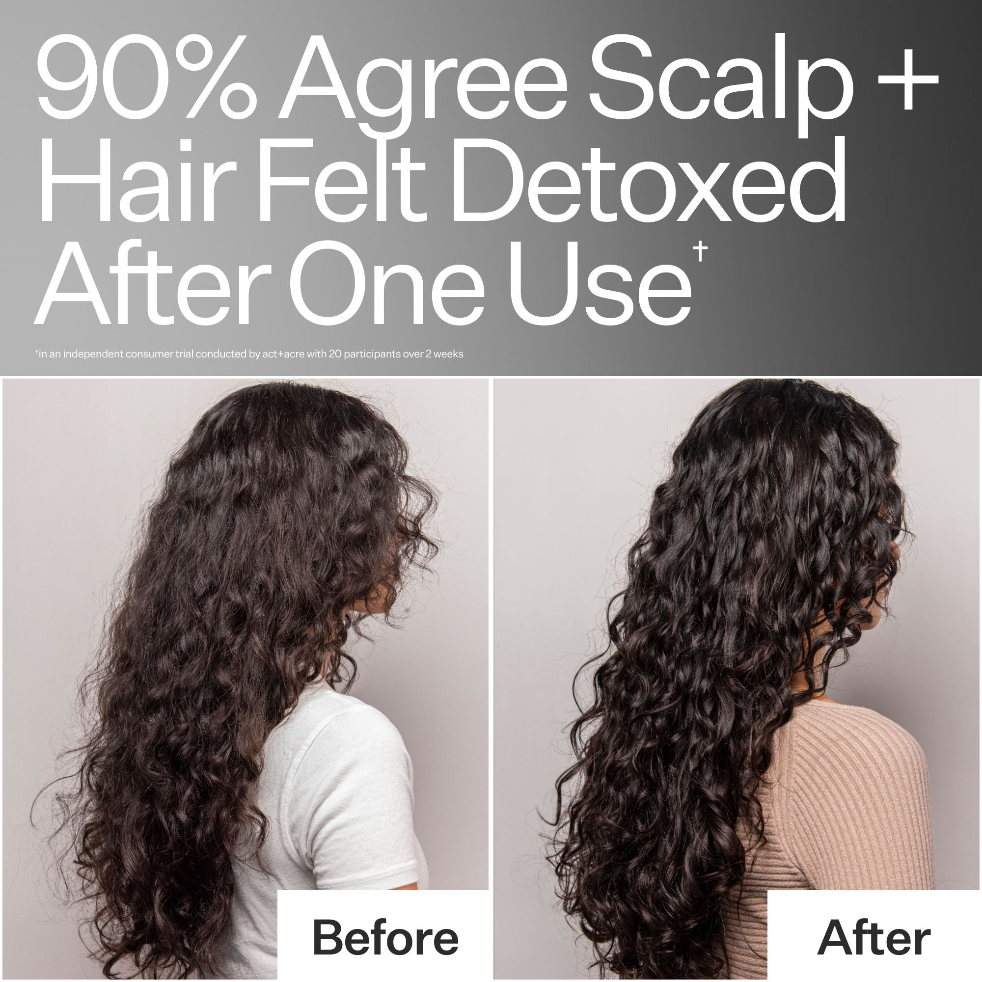 Clarifying Hard Water Scalp Treatment For Scalp + Hair Build-Up