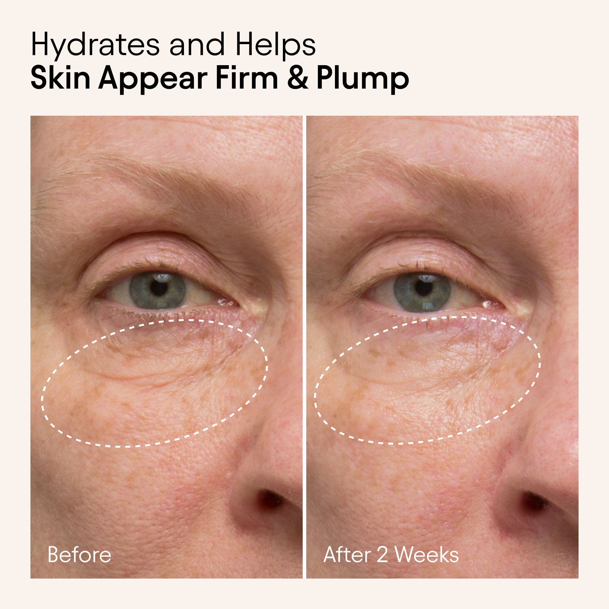 Hydrating Firming Serum with Niacinamide and Nettle