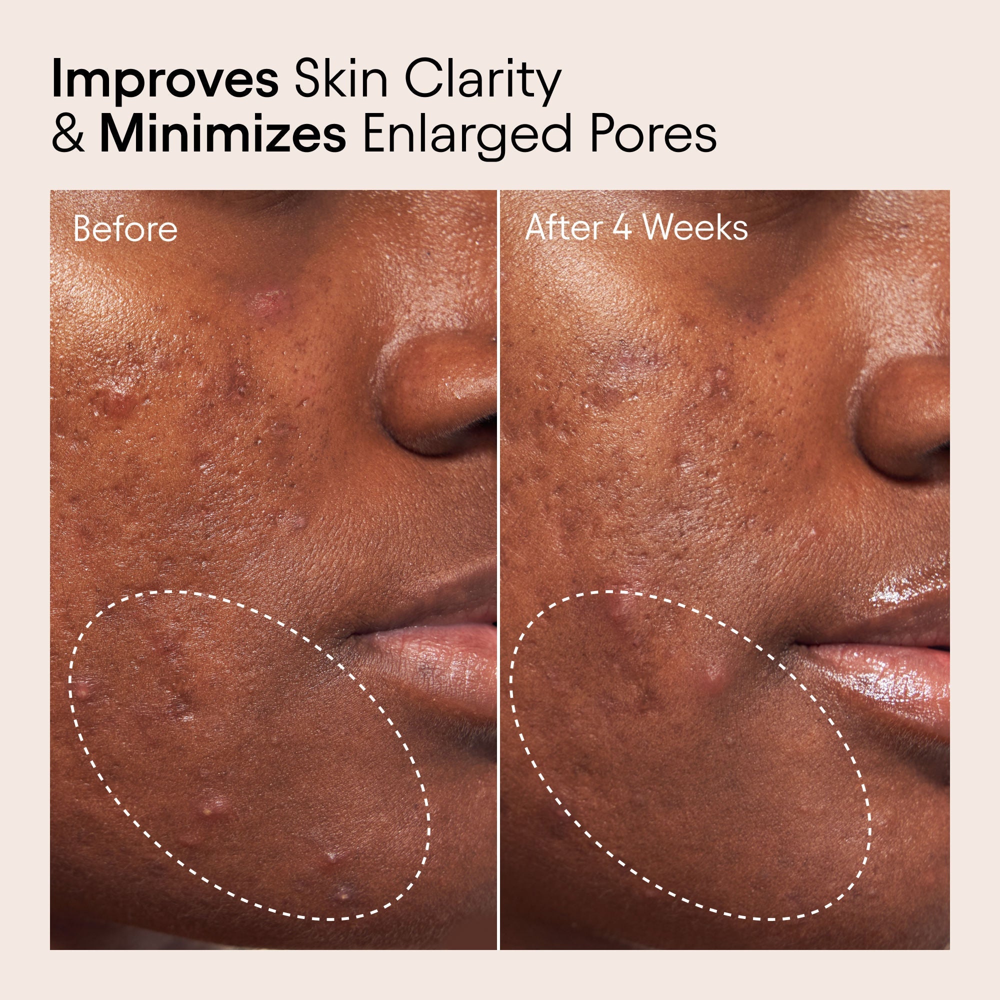 2% BHA Pore Perfecting Liquid Exfoliator for Brighter and Clearer Skin
