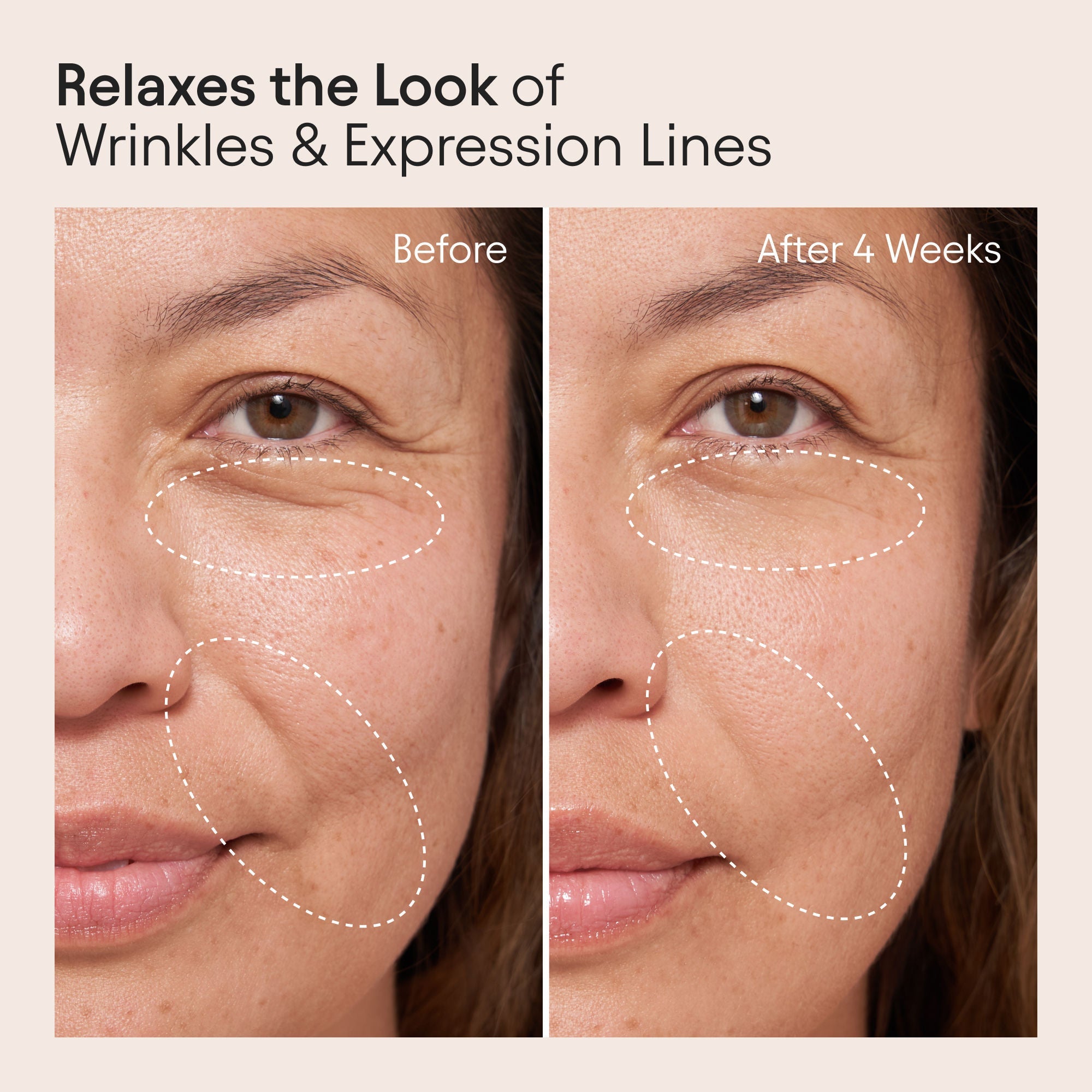 Barrier Repair Cream Moisturizer for Eczema, Wrinkle and Barrier Repair