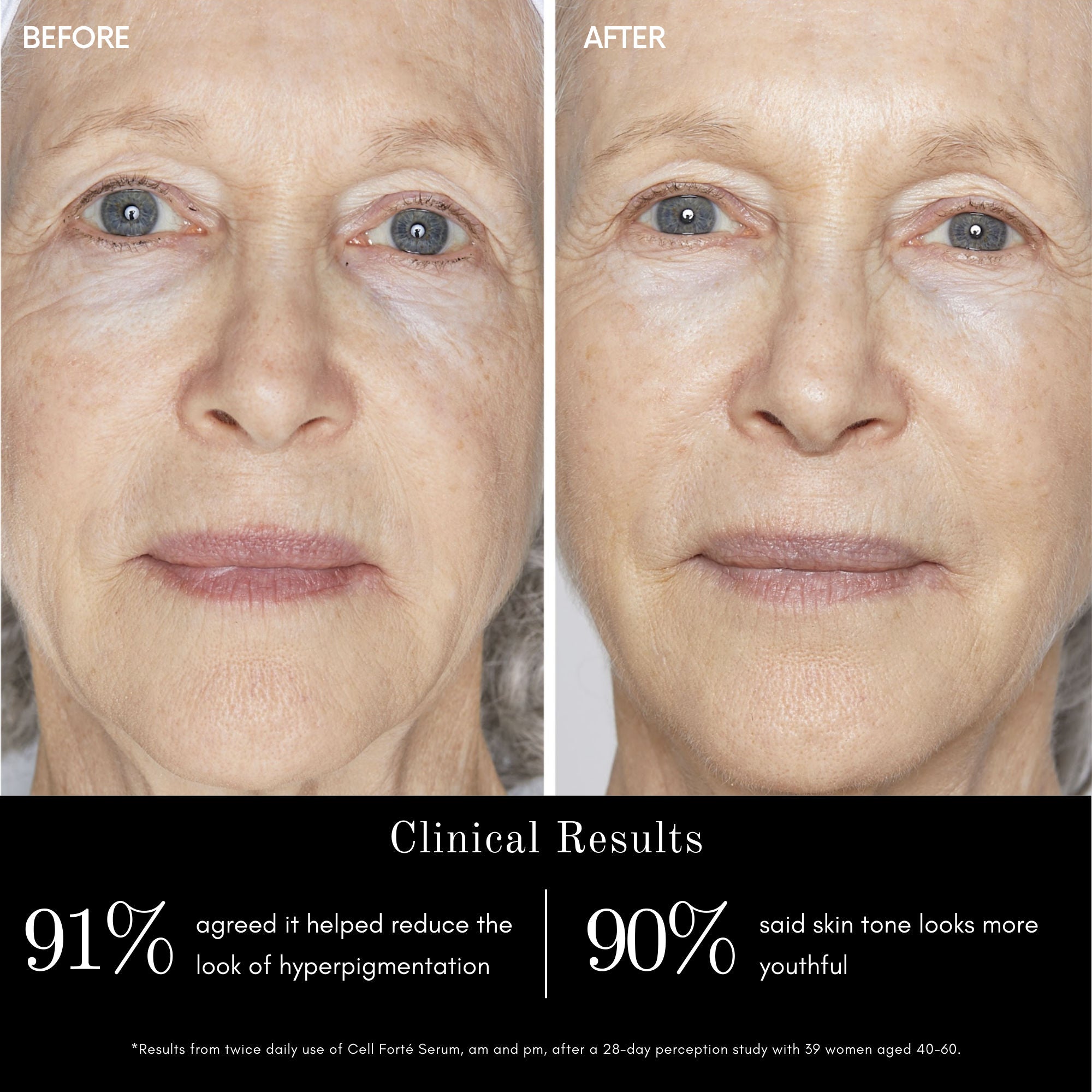 Cell Forté Serum with BIOMSC™