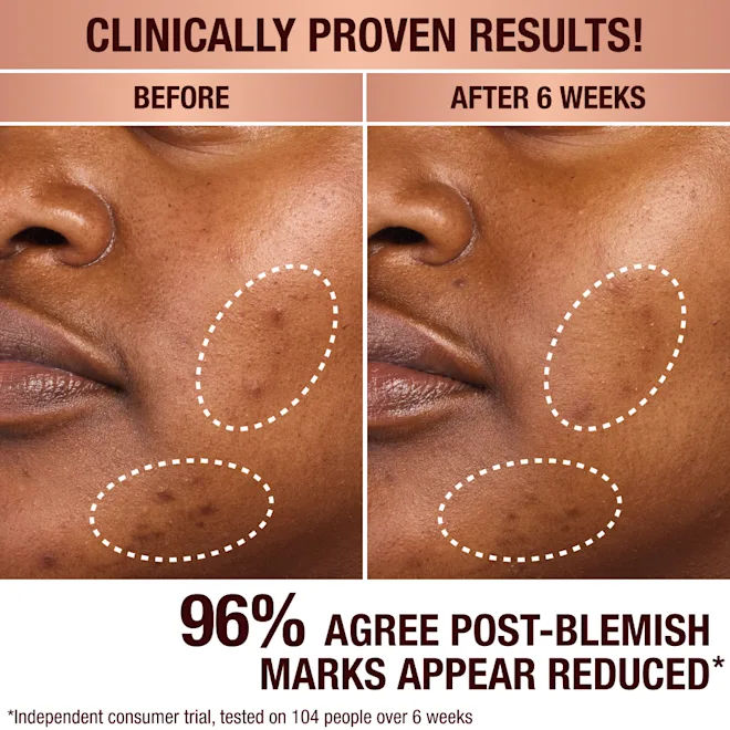 Dark Spot Correcting Radiance Recovery Serum