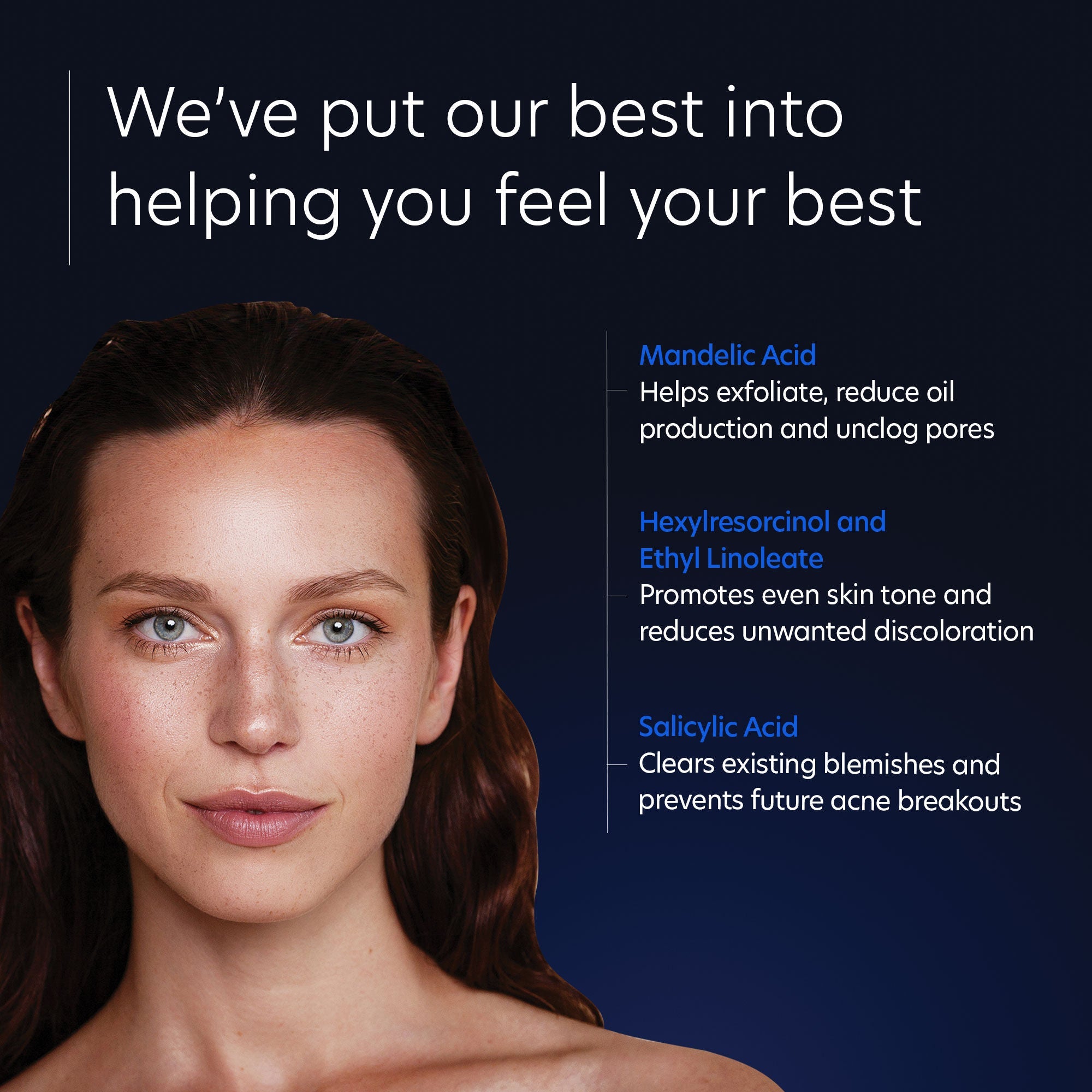 Acne Gel With OmniSome