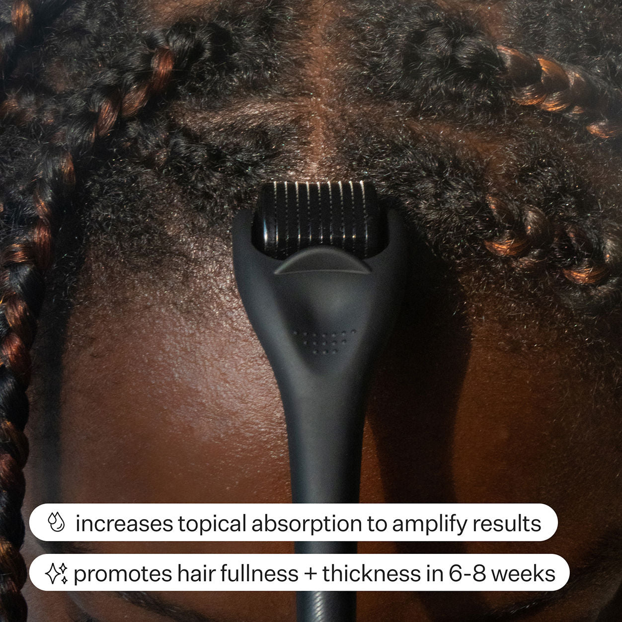 Dermaroller Hair System