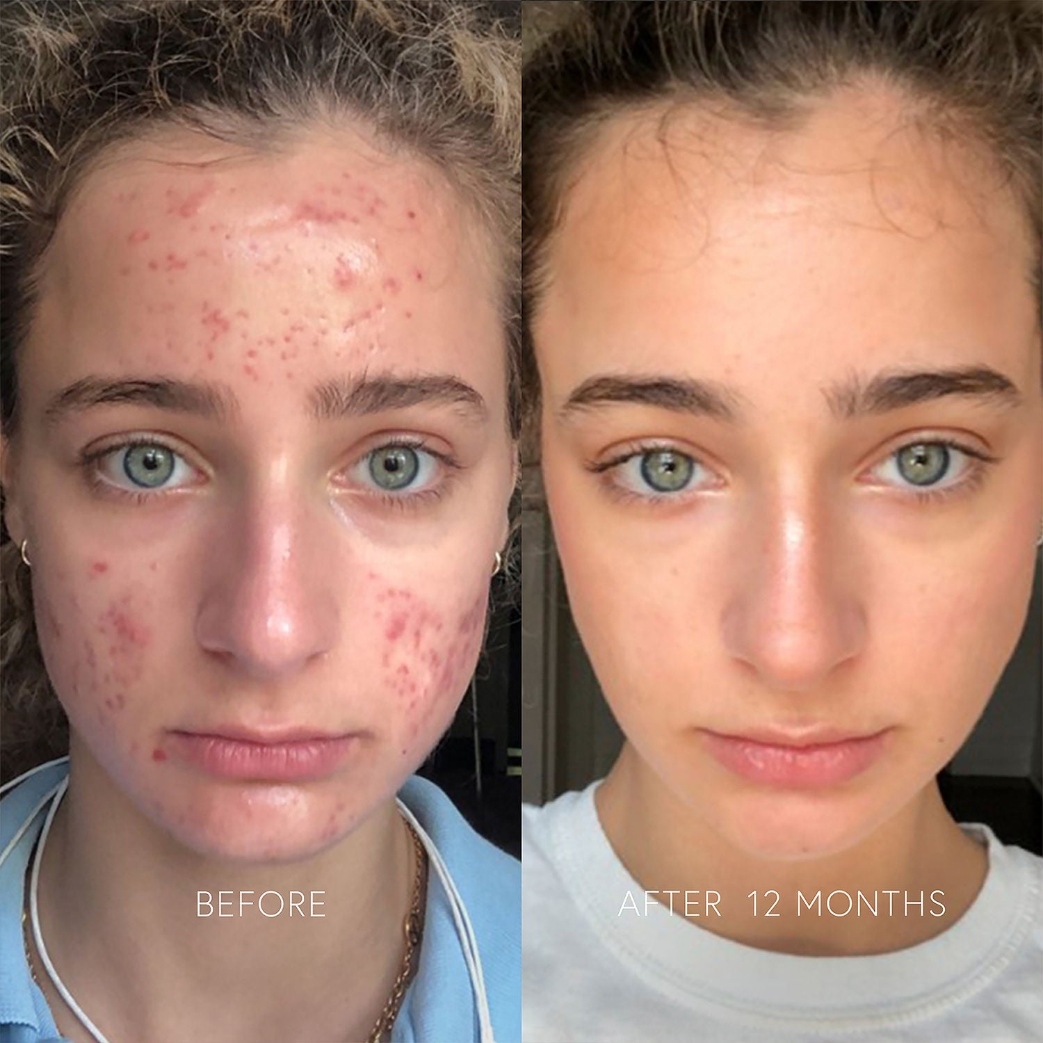 Clarifying Face Cream