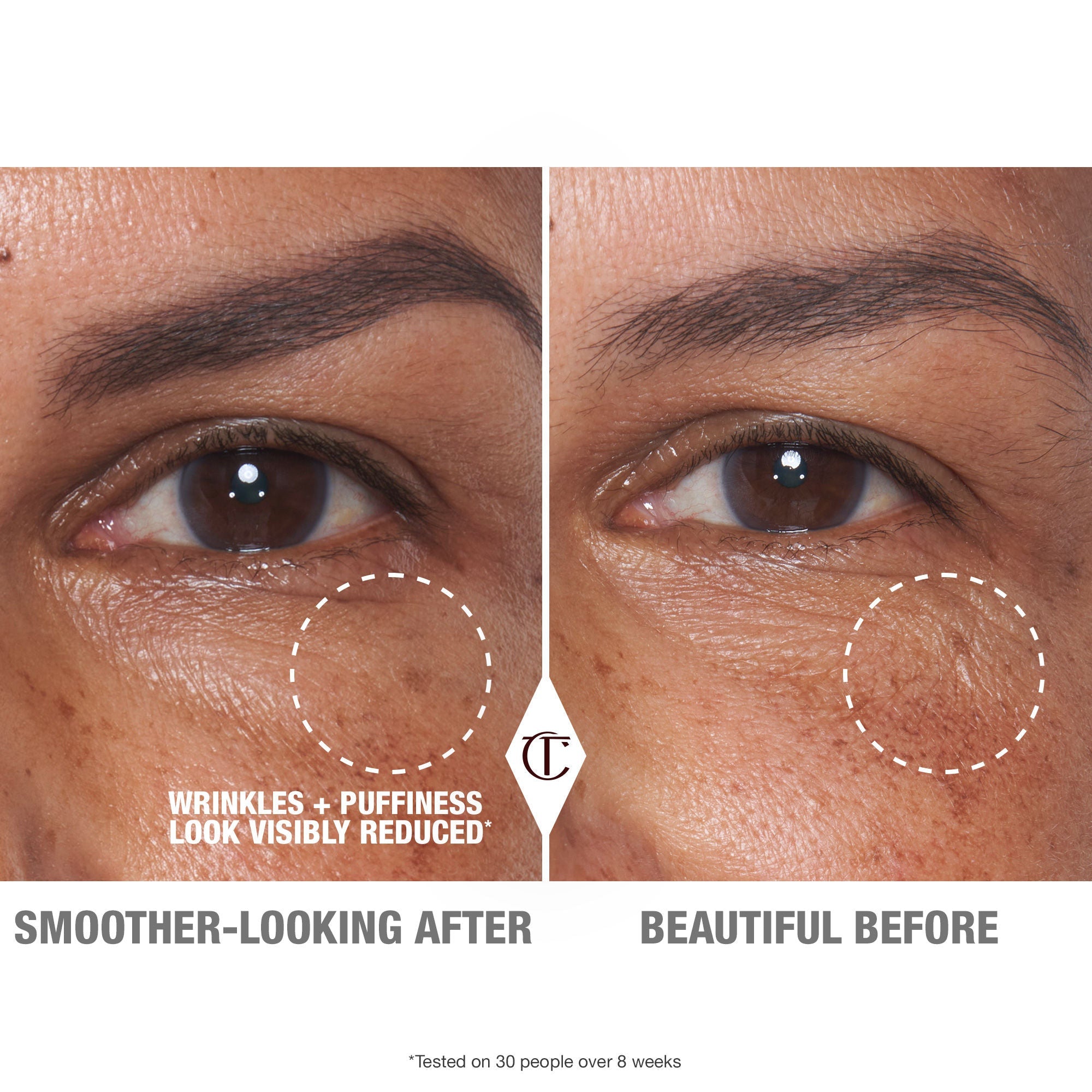 Cryo Recovery Eye Serum