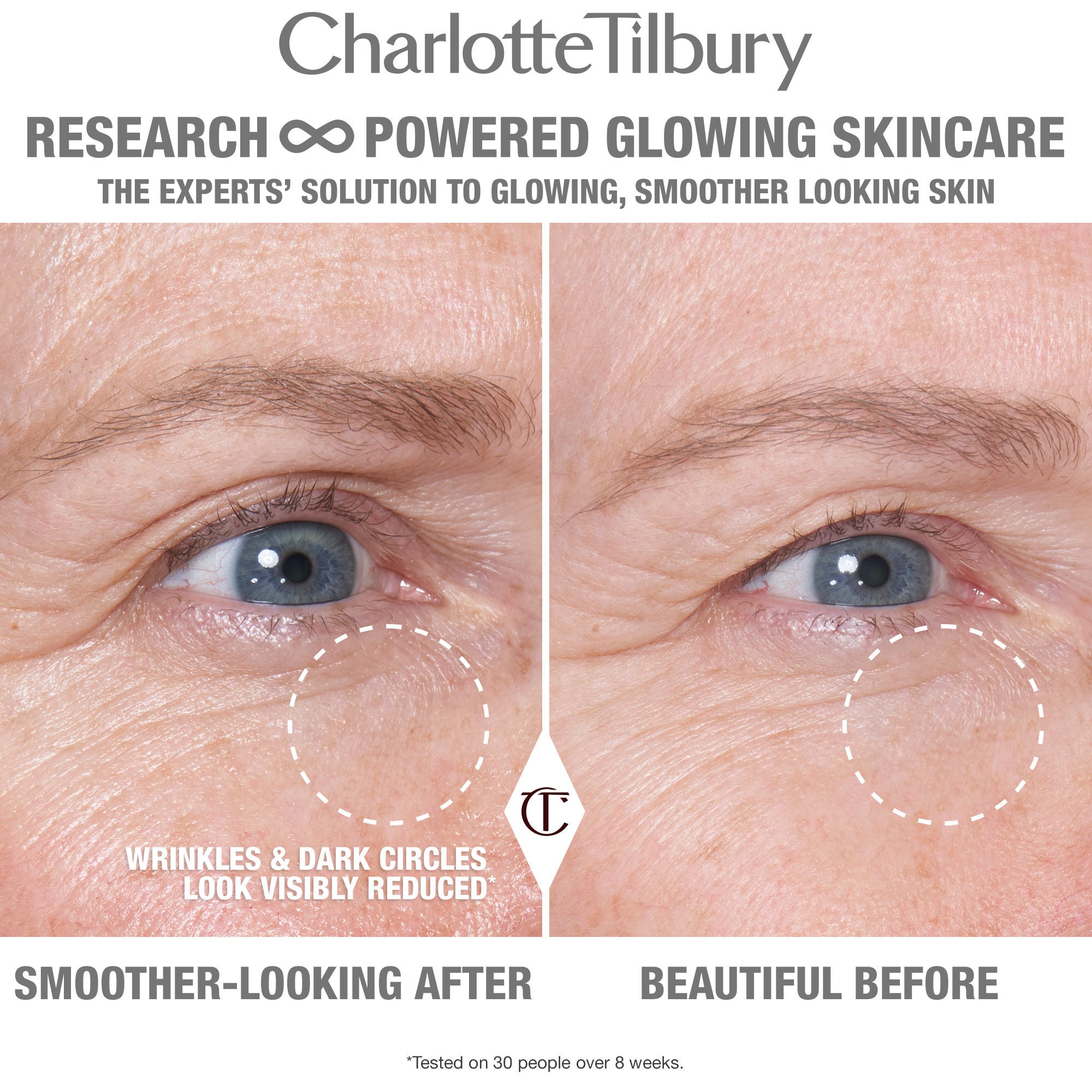 Cryo Recovery Eye Serum