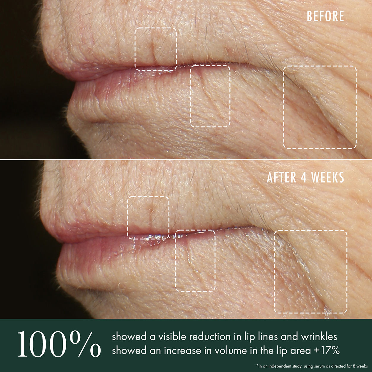 Advanced Lip Perioral Serum Targeted Vertical Line Filler