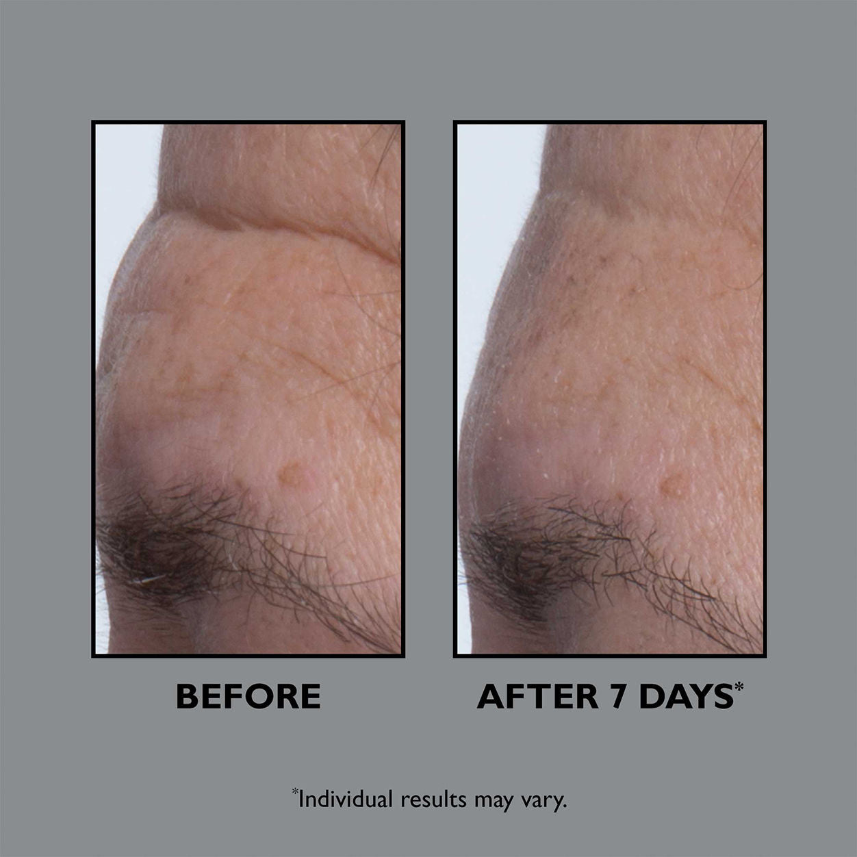 FIRMx Collagen Serum