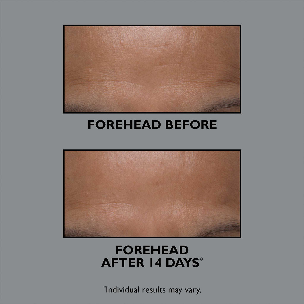 FIRMx Collagen Moisturizer