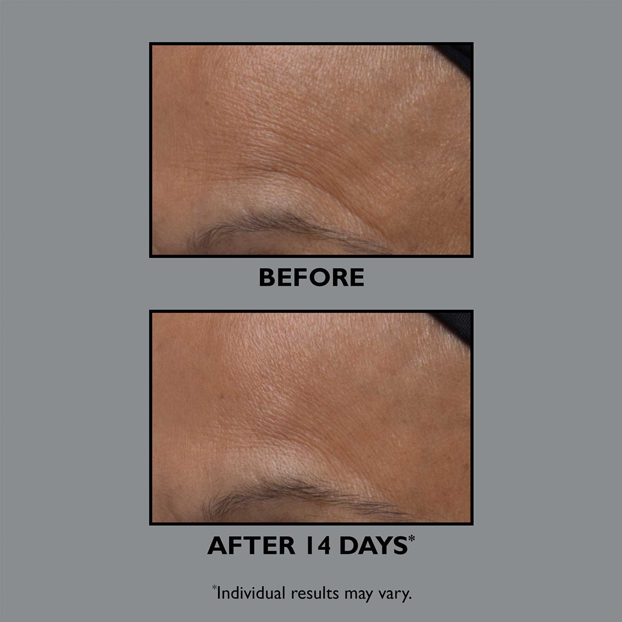 FIRMx Collagen Moisturizer