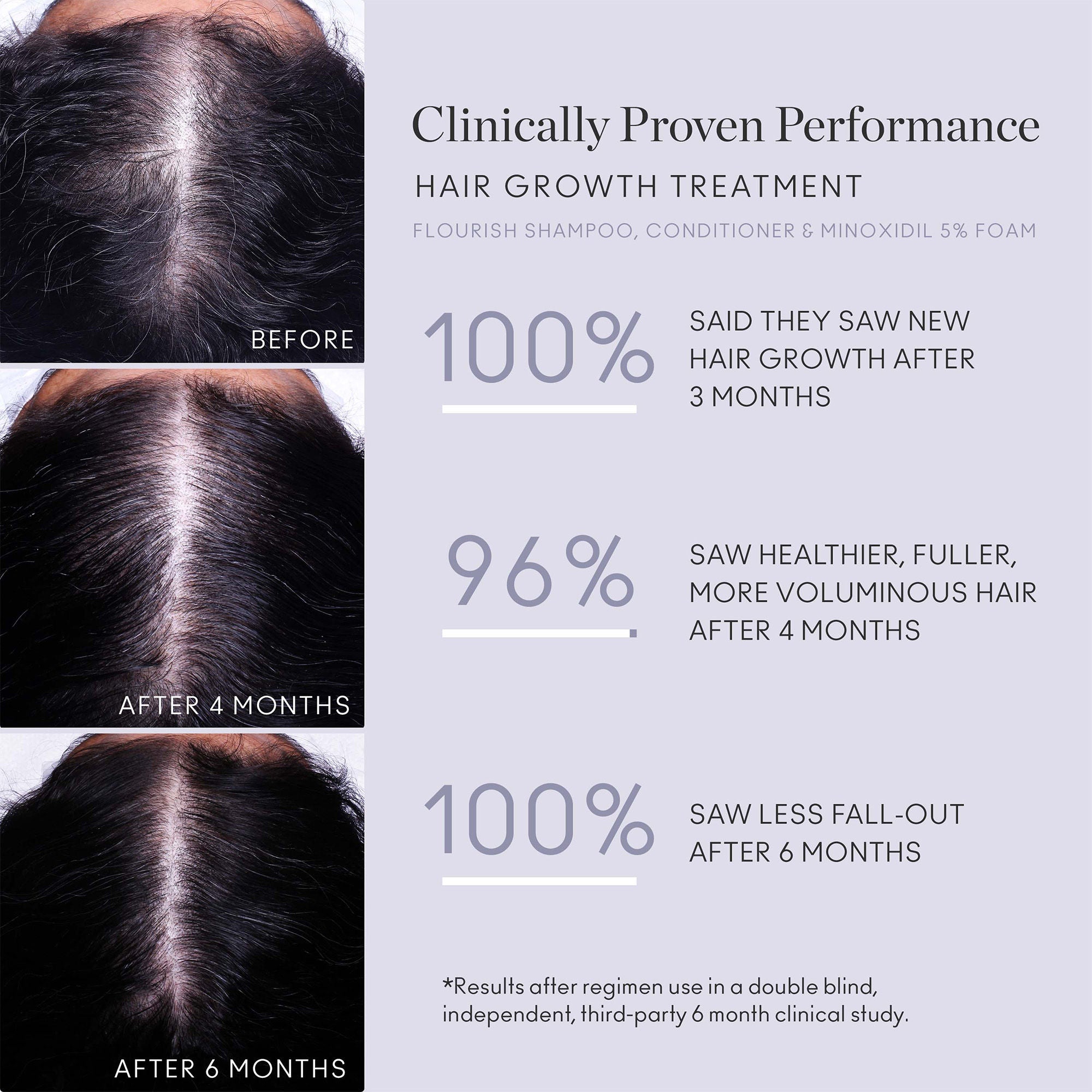 Flourish Nightly Intensive Hair Growth Treatment 90 Day