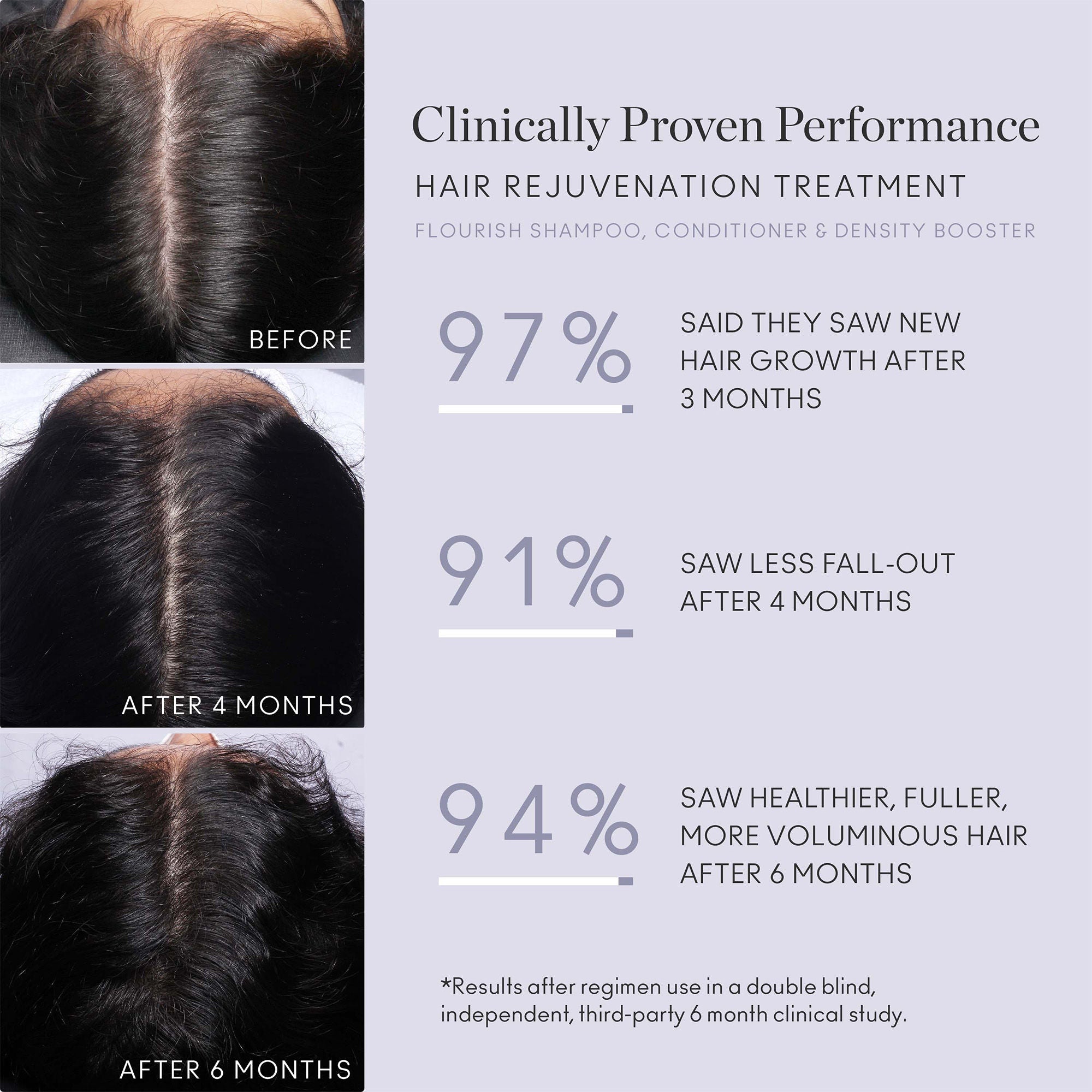 Flourish Nightly Intensive Hair Rejuvenation Treatment 30 Day