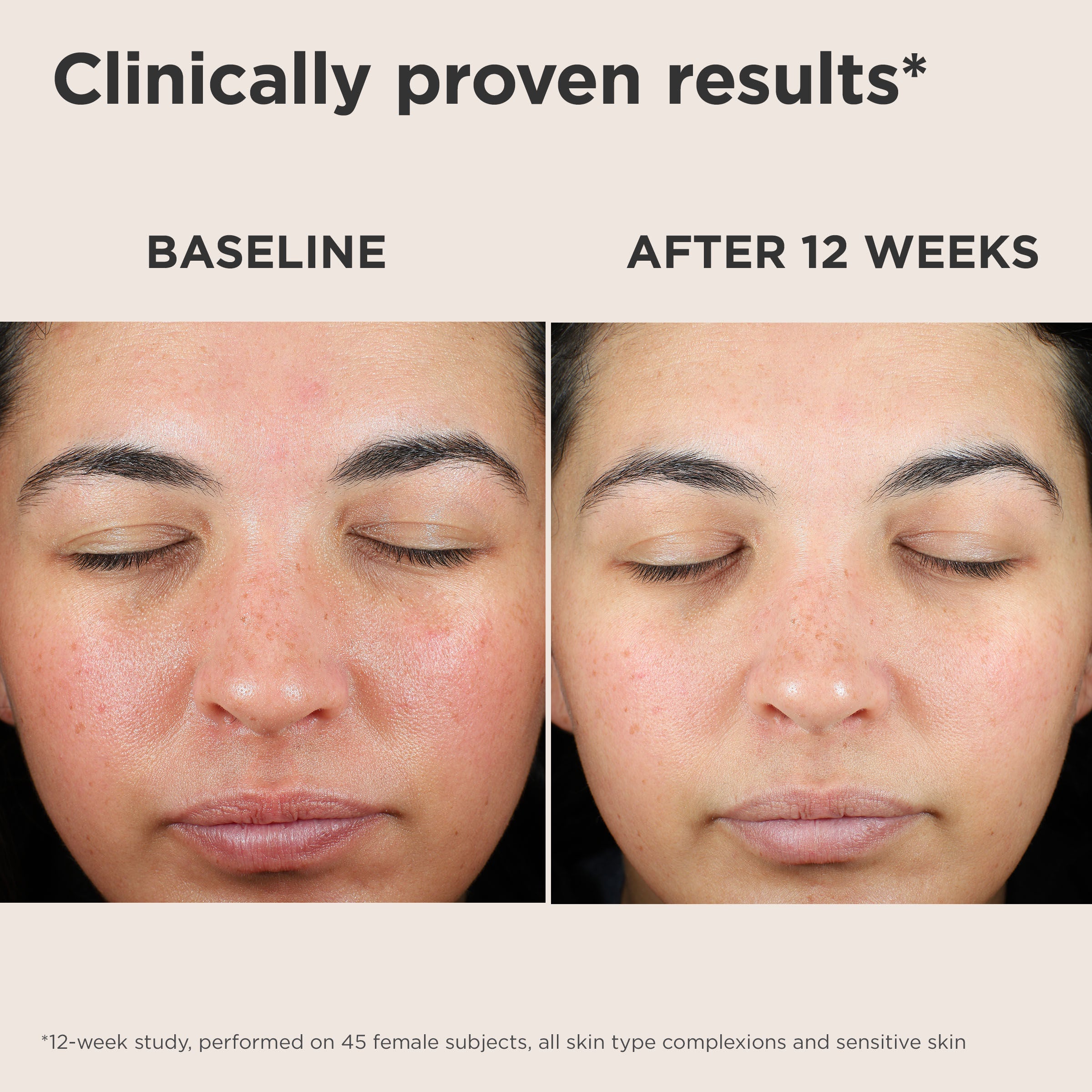 UV Skin Recovery Broad Spectrum SPF 50