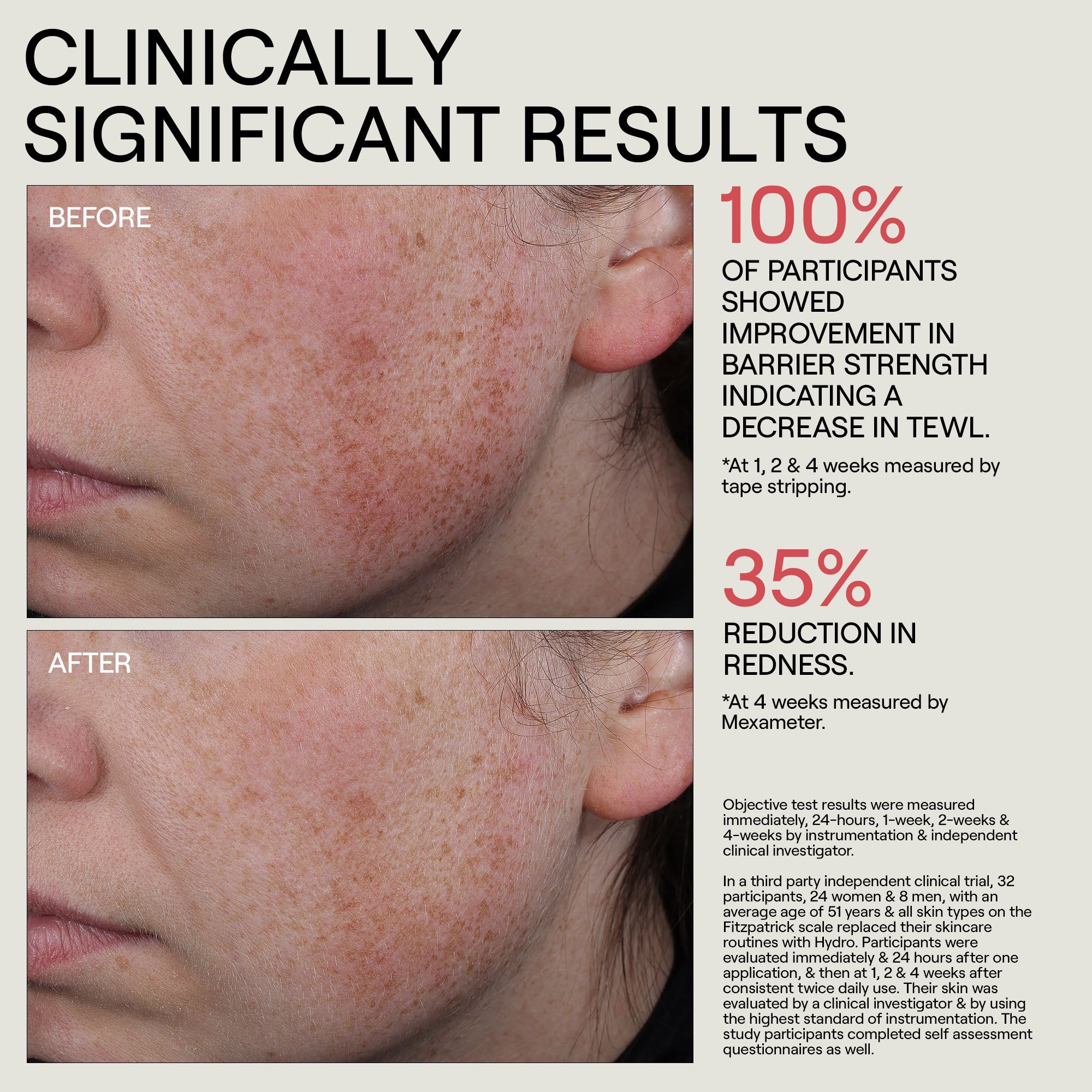 HYDR/O Bioactive Hydrolipid Barrier Moisturizer