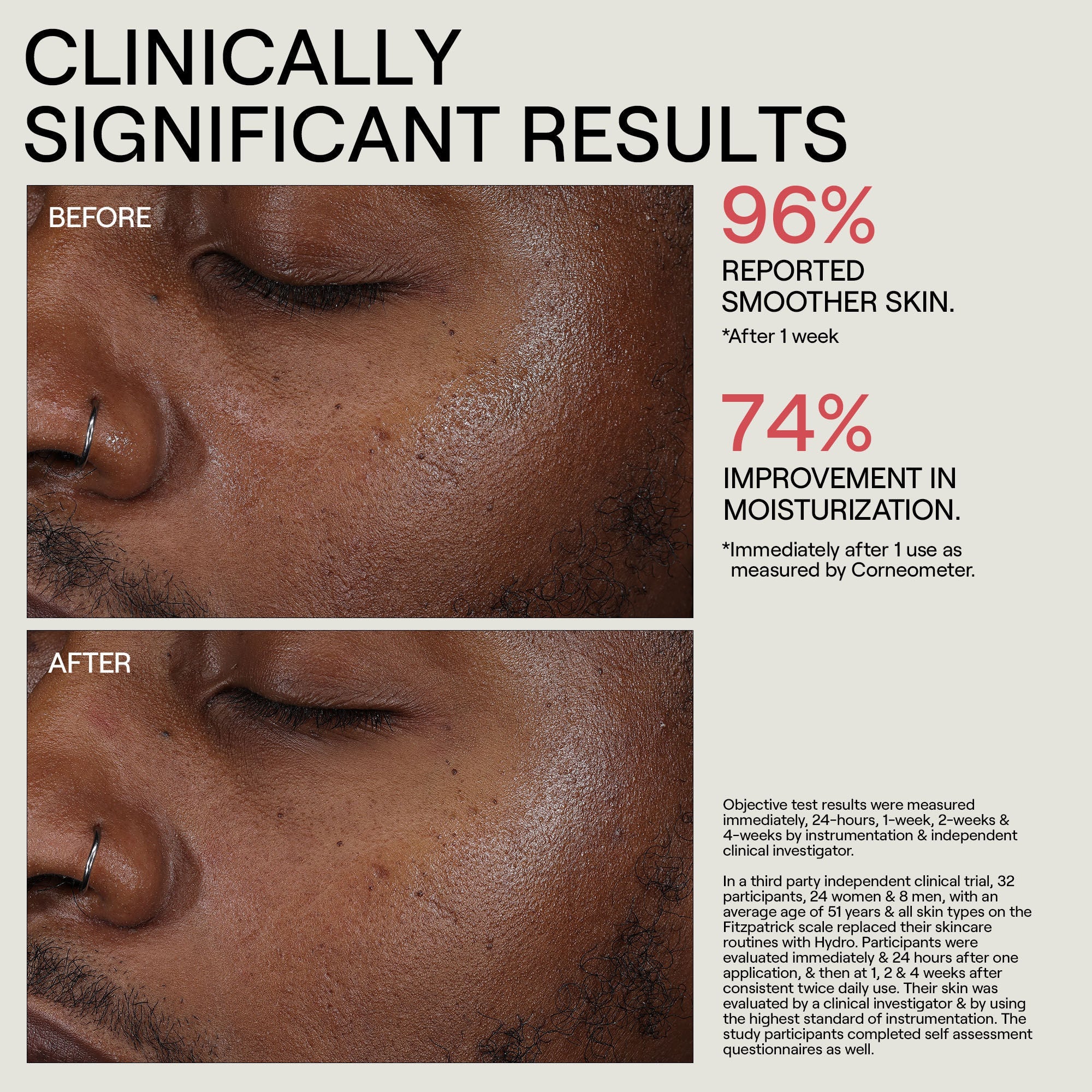 HYDR/O Bioactive Hydrolipid Barrier Moisturizer