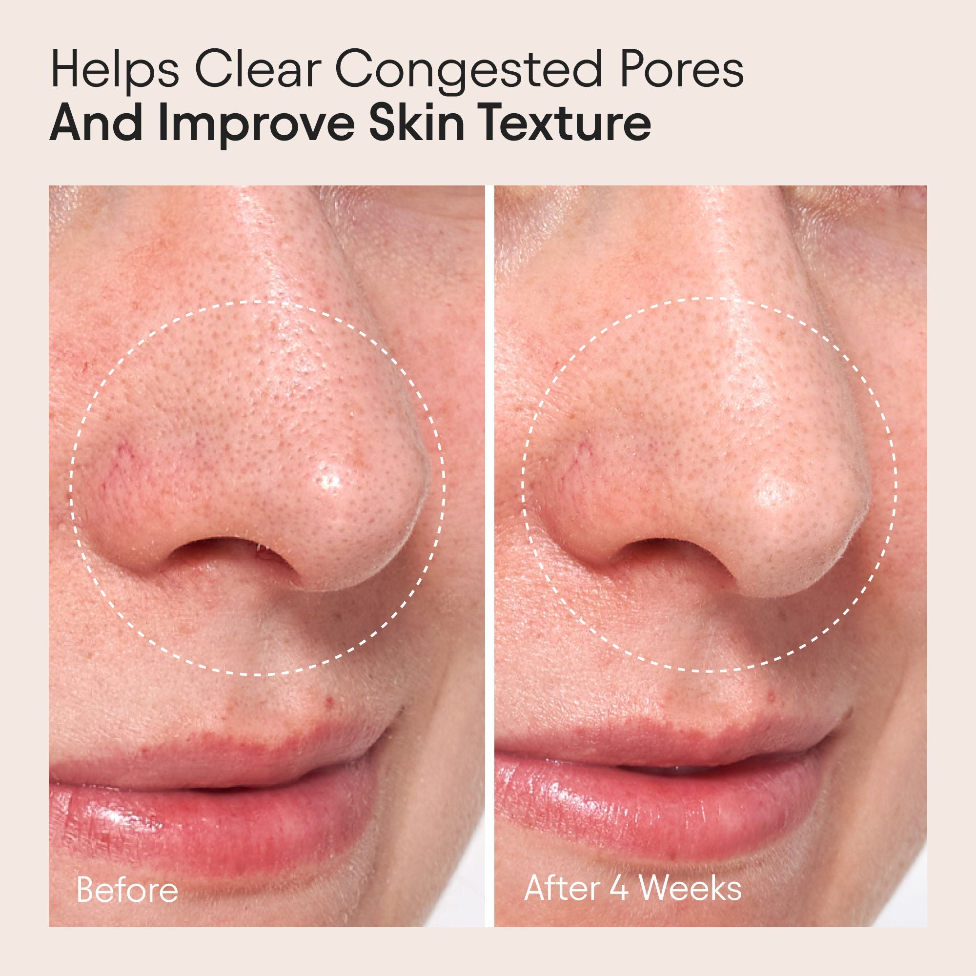 Clarifying Facial Oil with Retinol and Pink Algae