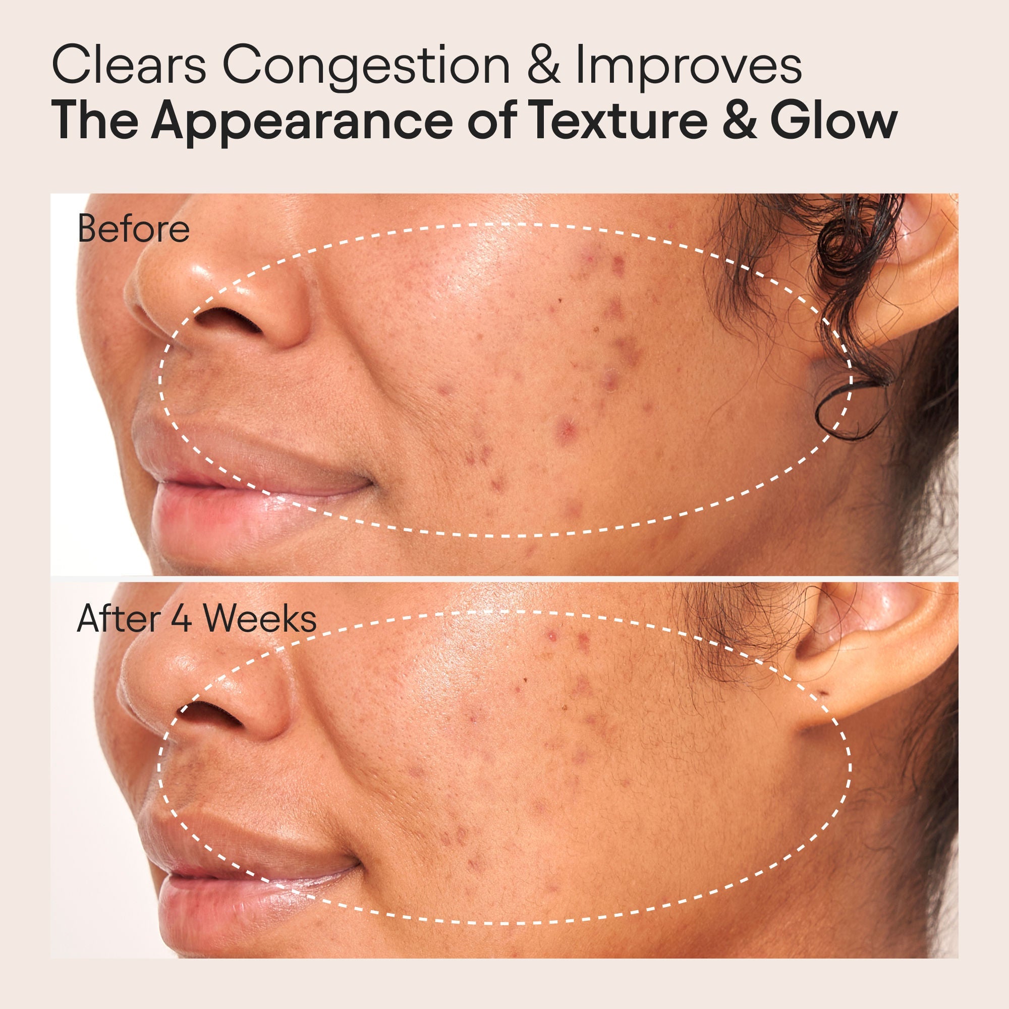 Clarifying Facial Oil with Retinol and Pink Algae