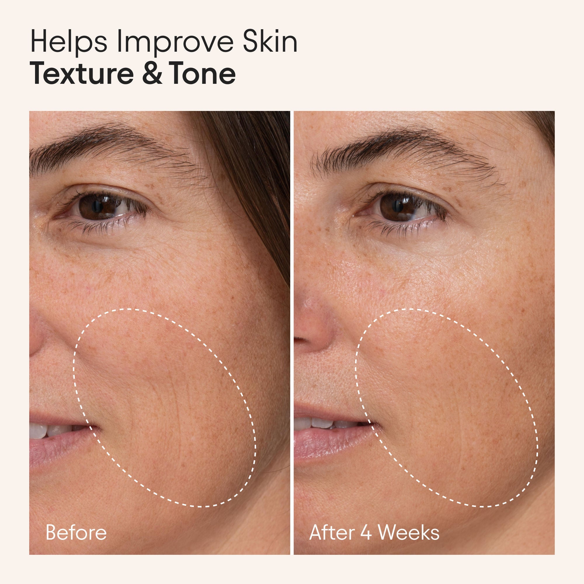 Hydrating Firming Serum with Niacinamide and Nettle