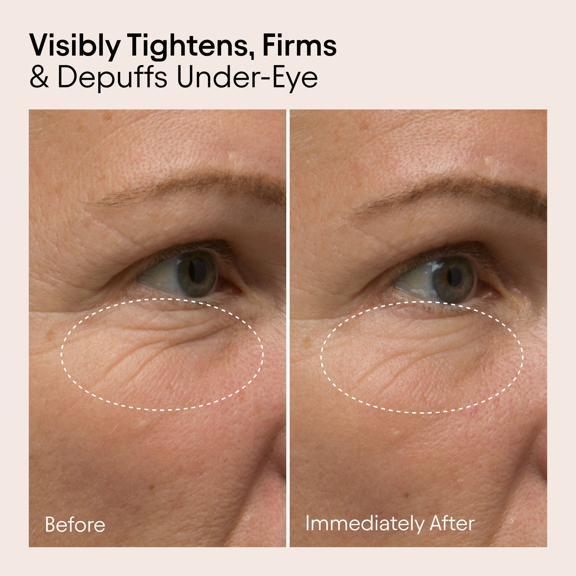 Line-Filling Eye Cream with Bakuchiol and Caffeine