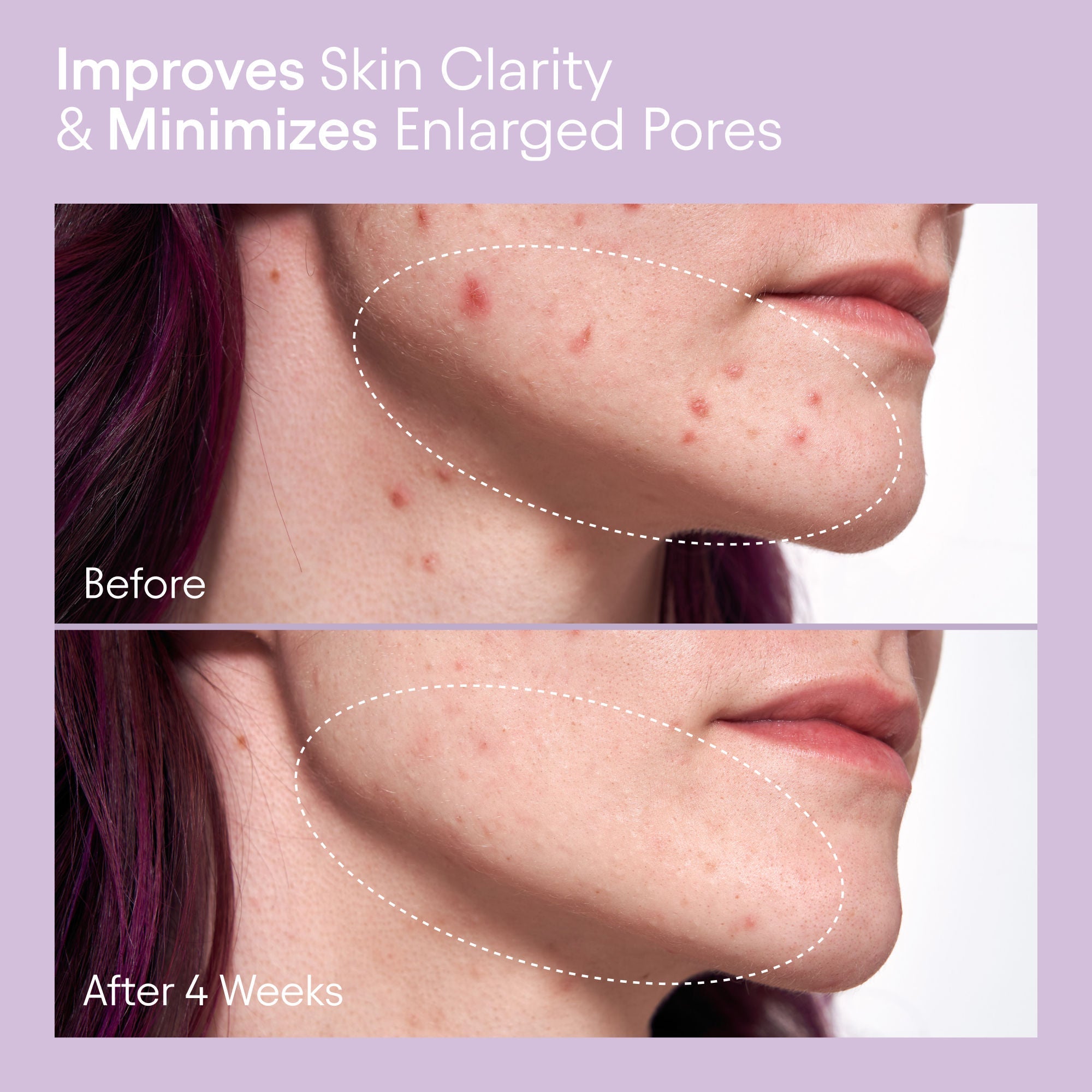 2% BHA Pore Perfecting Liquid Exfoliator for Brighter and Clearer Skin