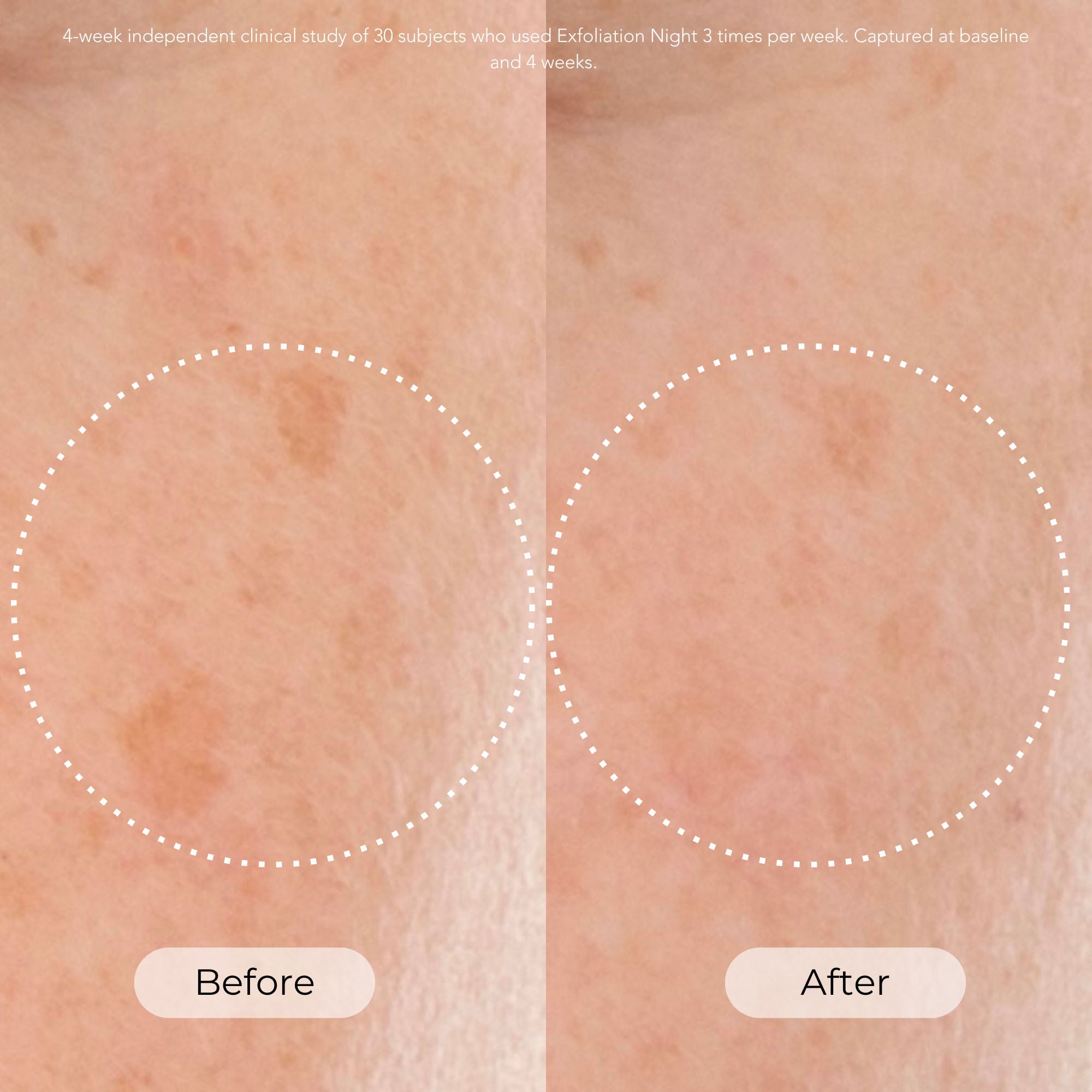 Exfoliation Night Resurfacing and Brightening Serum