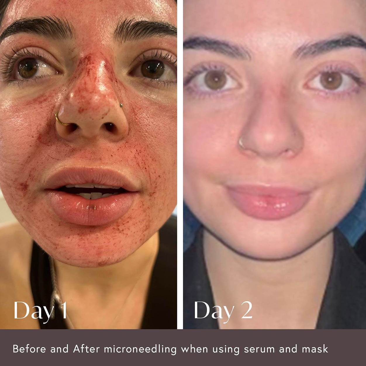 Hidden Agenda Pre and Post Injection Care Serum