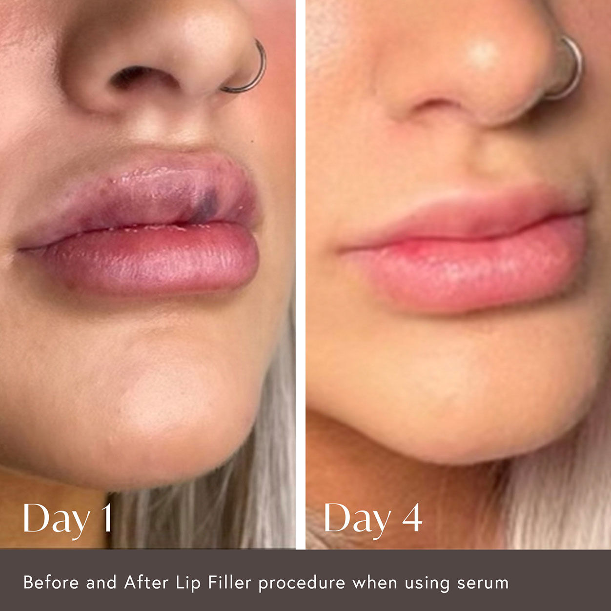 Hidden Agenda Pre and Post Injection Care Serum