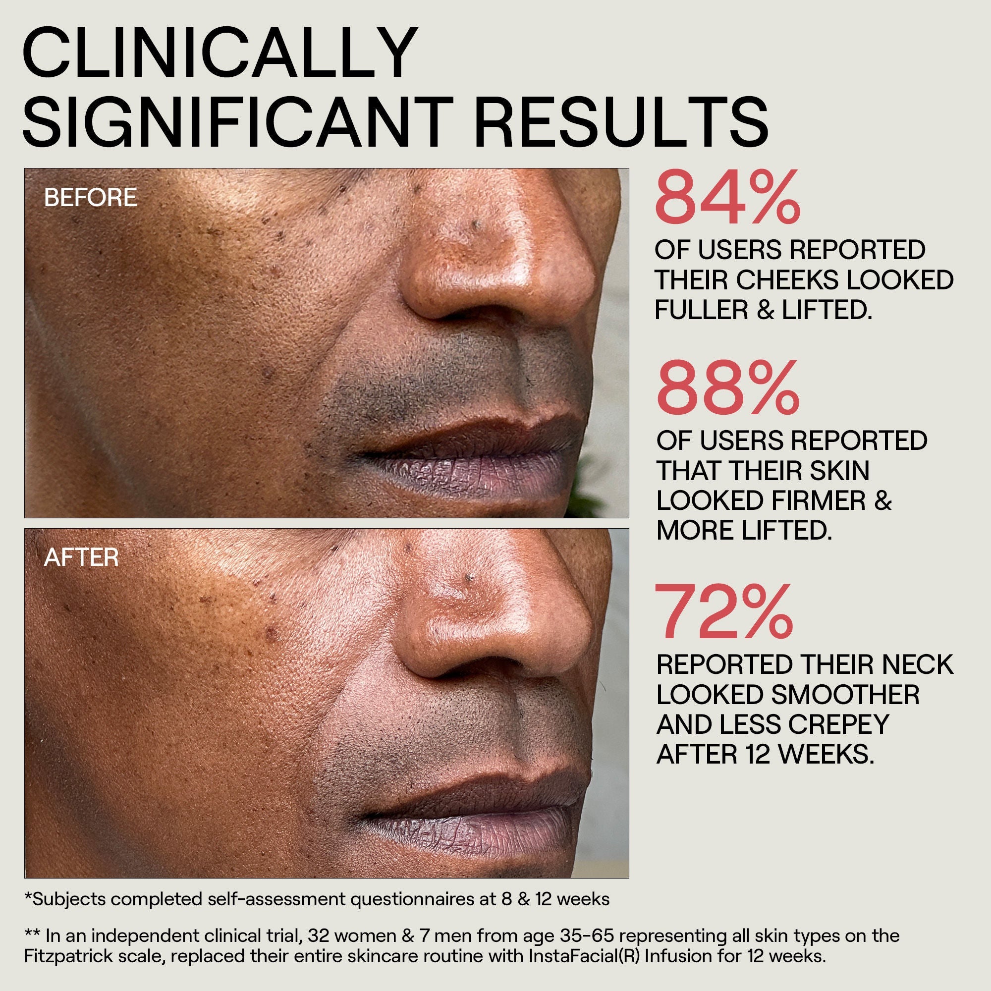 Instafacial Infusion Biomimetic Microcollagen Matrix
