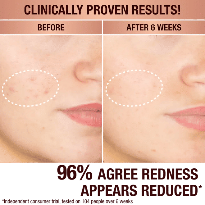 Dark Spot Correcting Radiance Recovery Serum